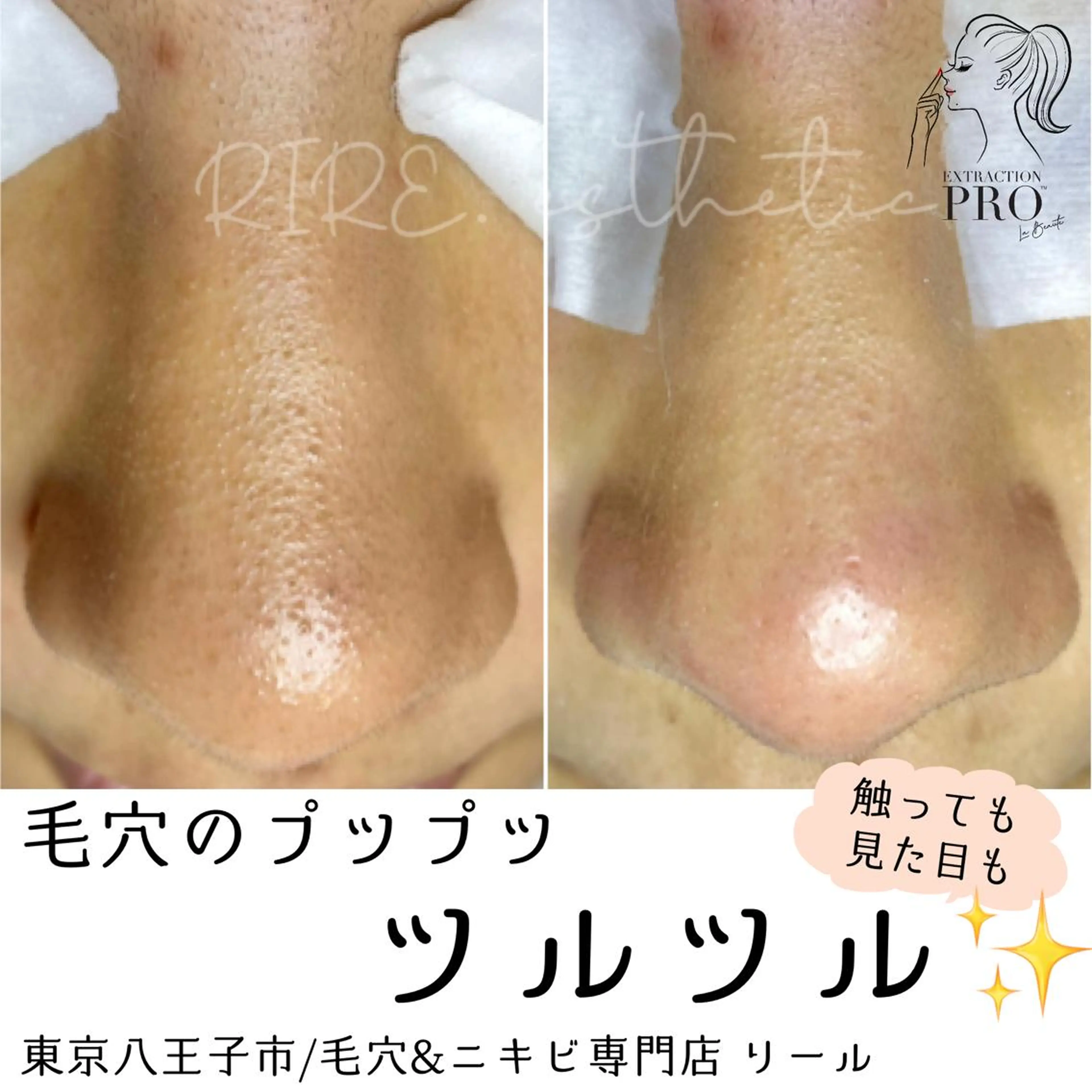 毛穴肌育専門店 リールのエステ・リラクイメージ