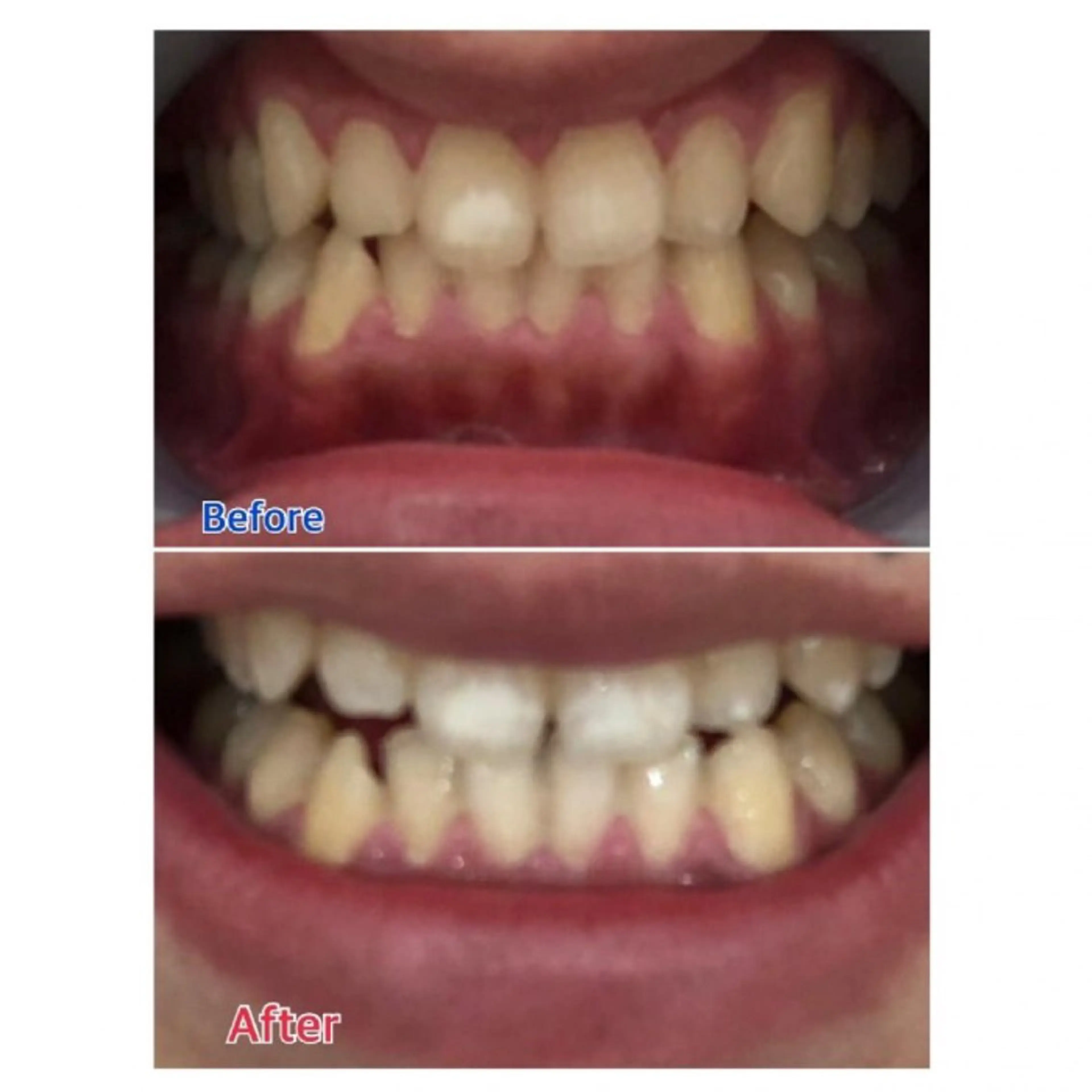 M渋谷店所属・Ｍ渋谷 ホワイトニングのエステ・リラクイメージ