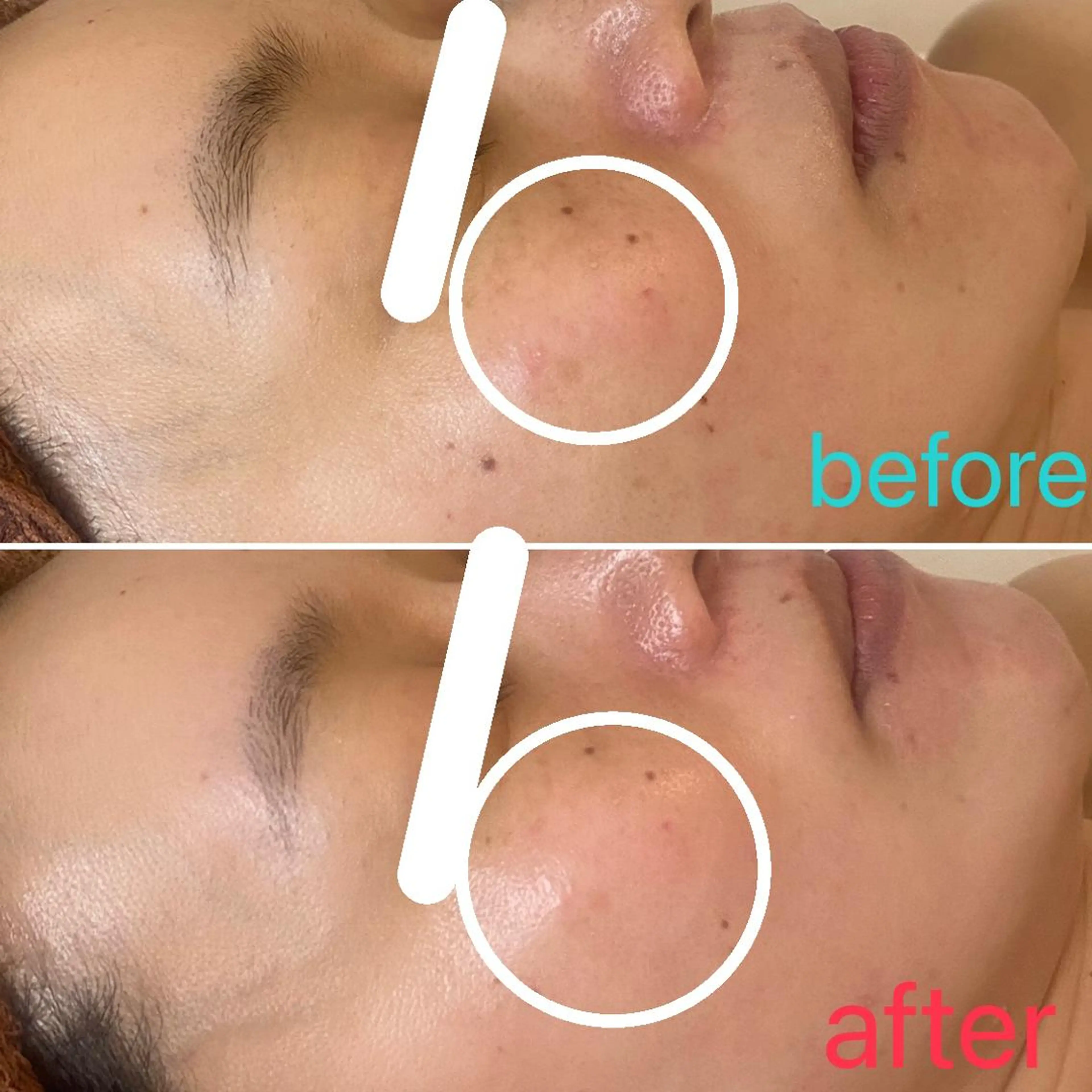 肌質改善|天王寺 For...はるかのエステ・リラクイメージ