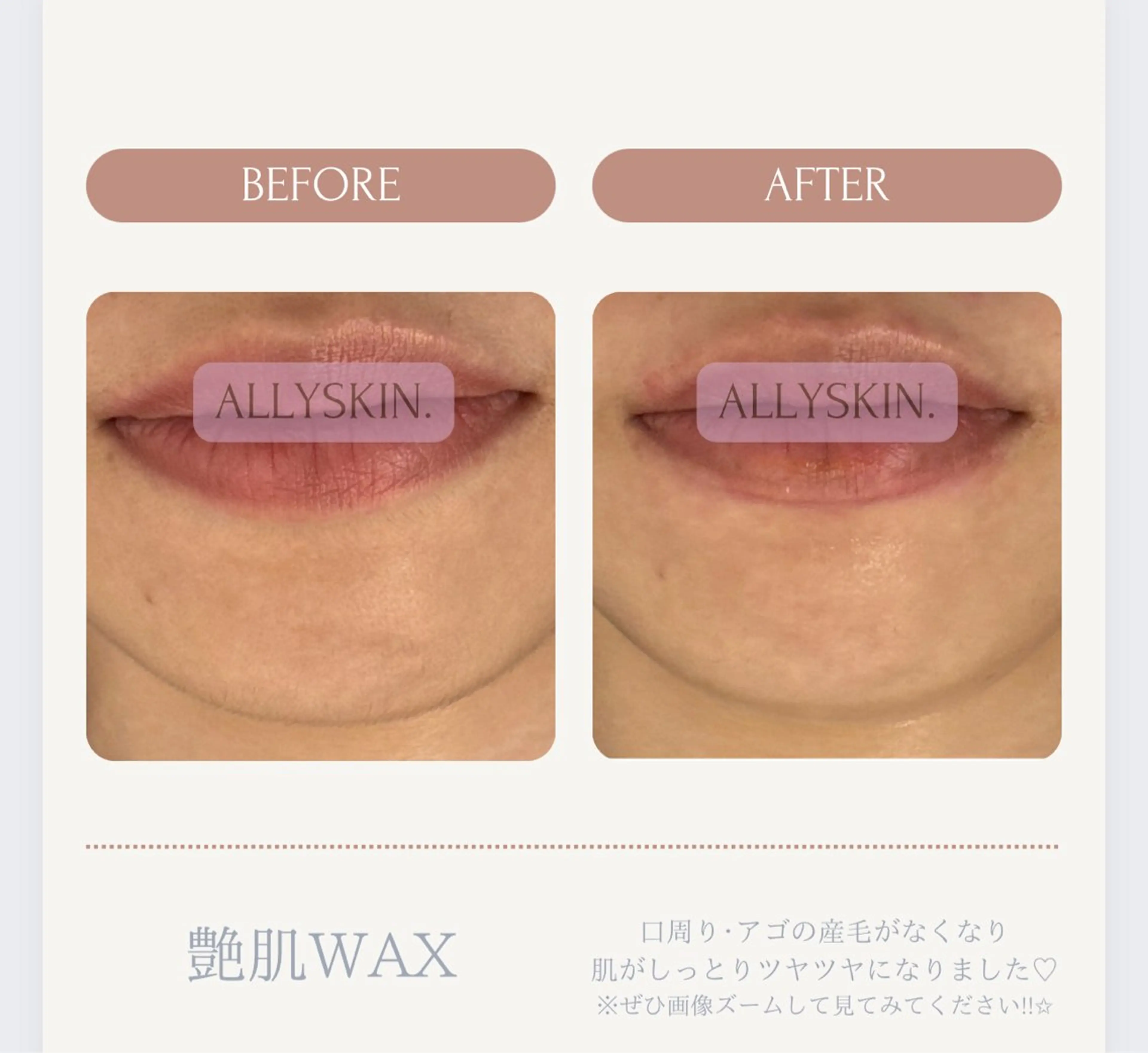 エステ 艶肌ワックス ALLY.のエステ・リラクイメージ