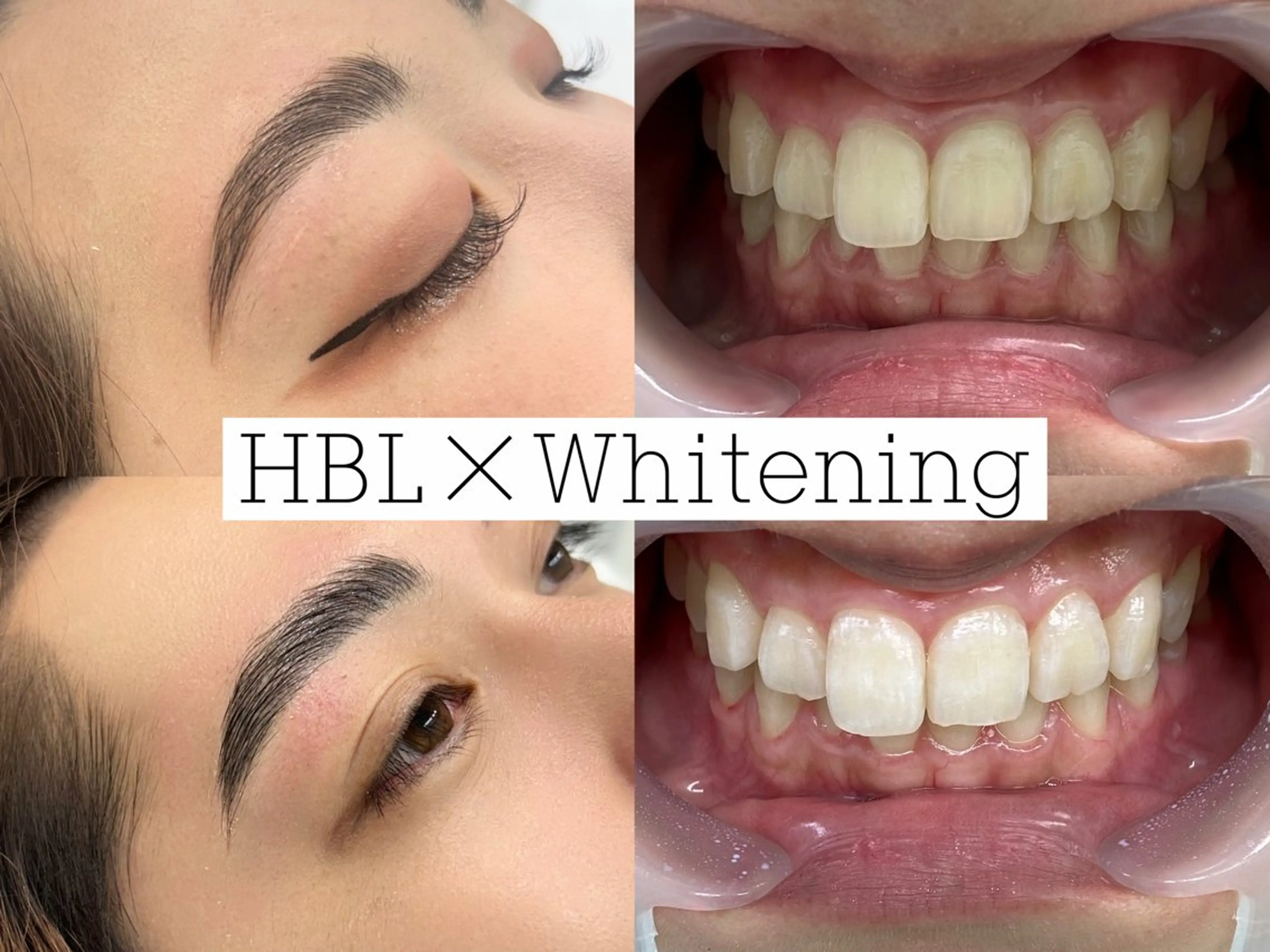 歯のホワイトニング専門店 MIGAQ 京都四条大宮店所属・佐藤 未来のその他イメージ