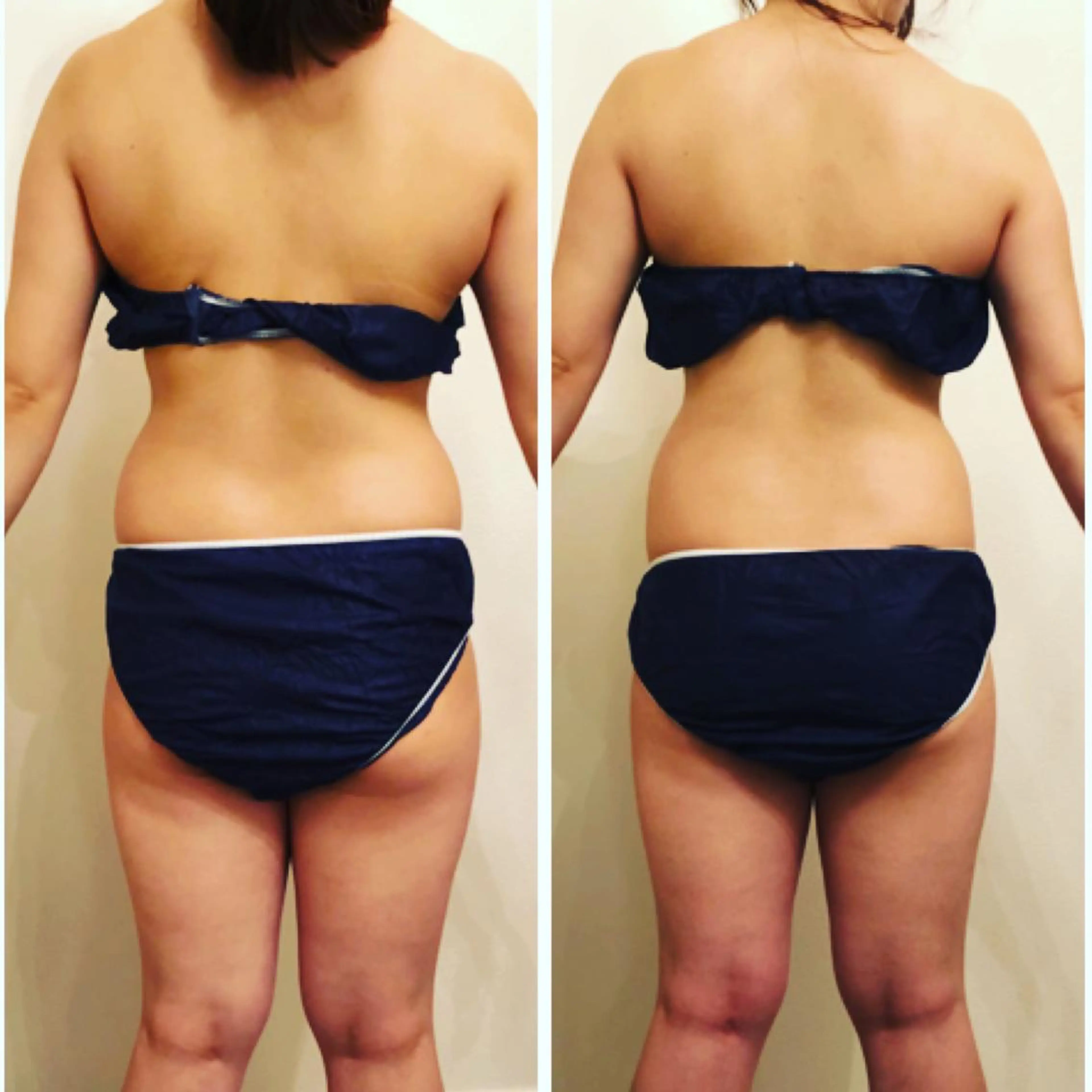 FLEUR大阪・整体 ・ハイフ・痩身・小顔のエステ・リラクイメージ