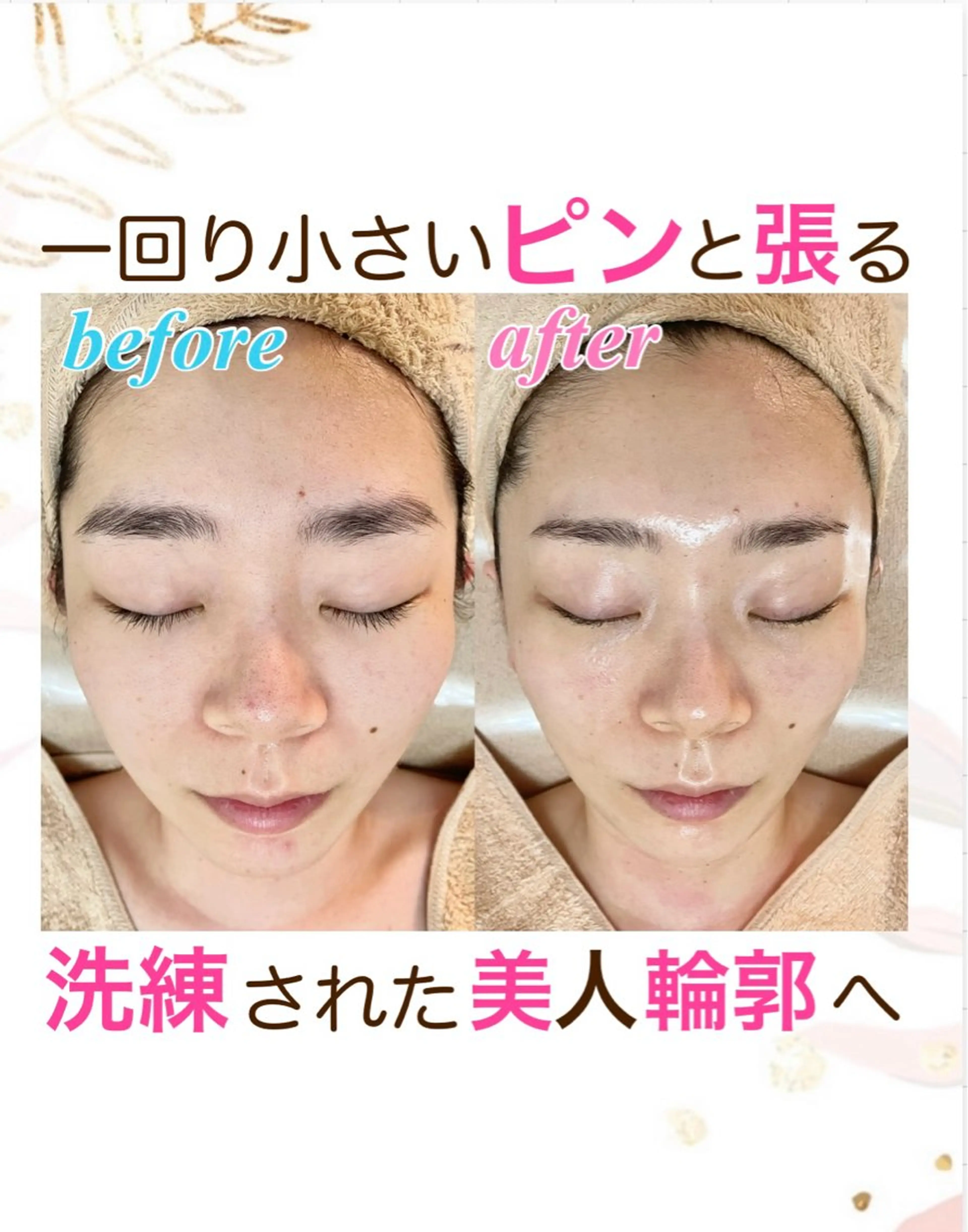 エステ オーダーメイドエステ　ソワンドビジュー所属・美肌×小顔専門/ 亀澤いずみのエステ・リラクイメージ