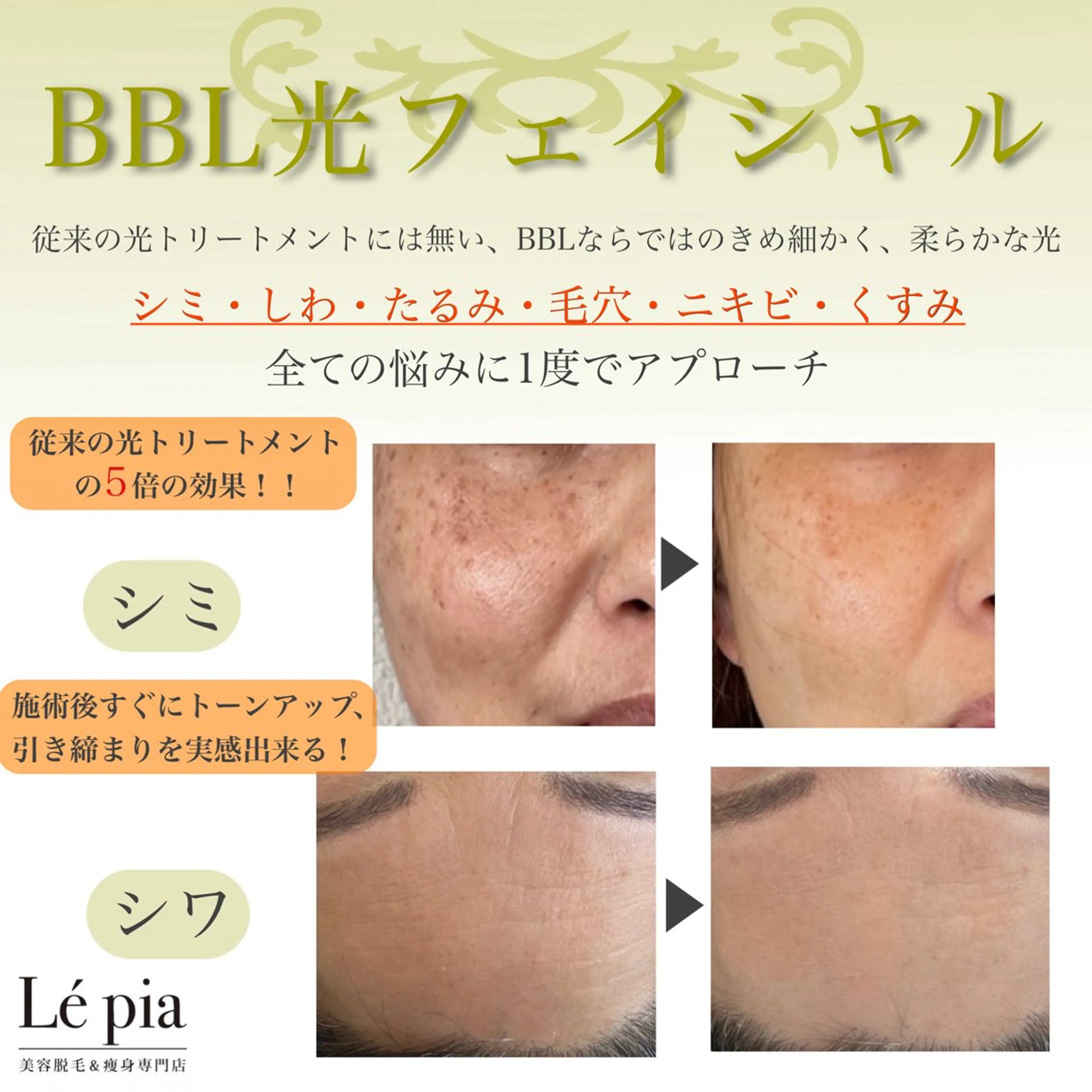 エステ 肌質管理専門店 Lé pia　AMIのエステ・リラクイメージ