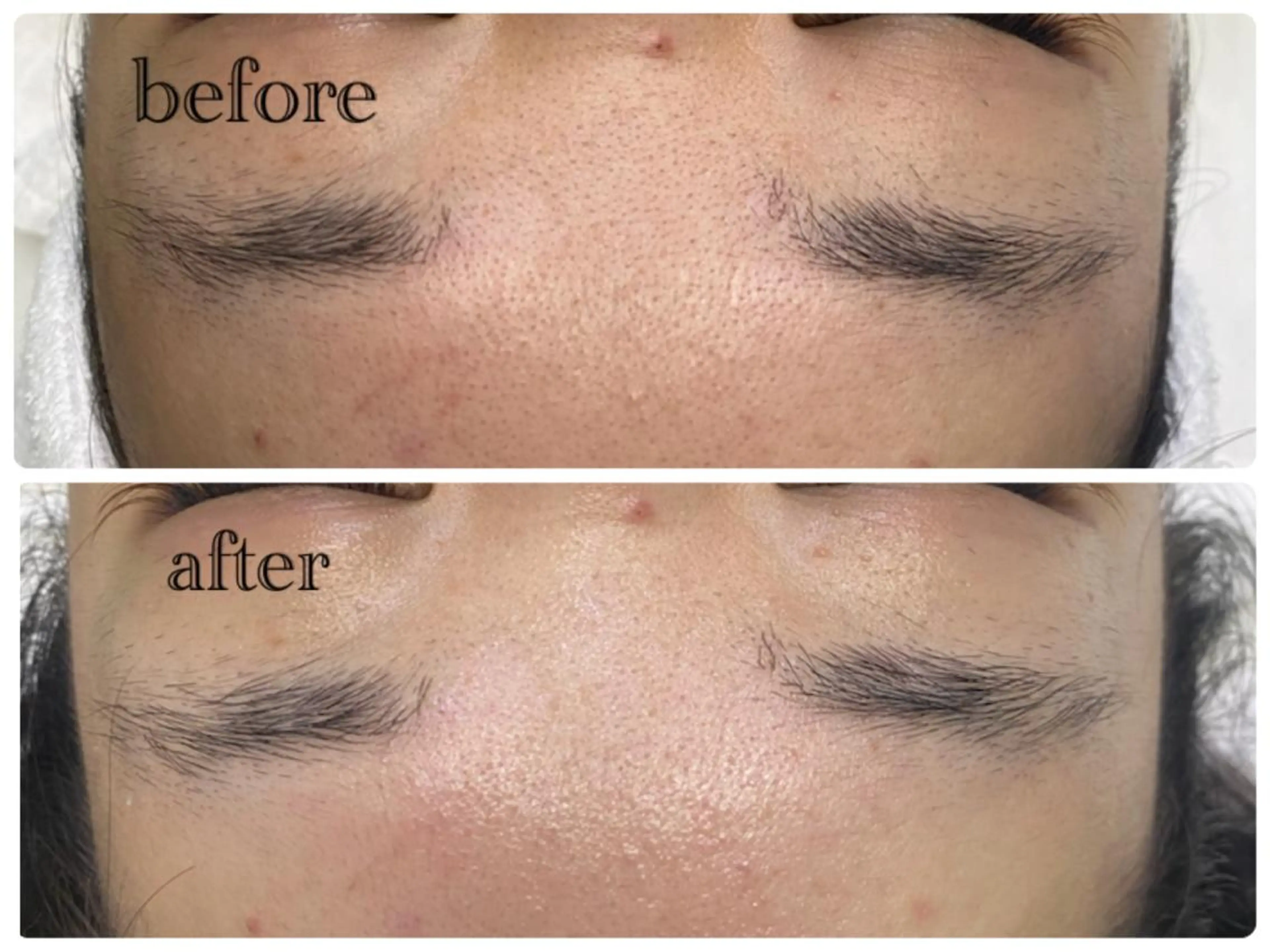 デ・アイム新潟北所属・サイトウ .のエステ・リラクイメージ