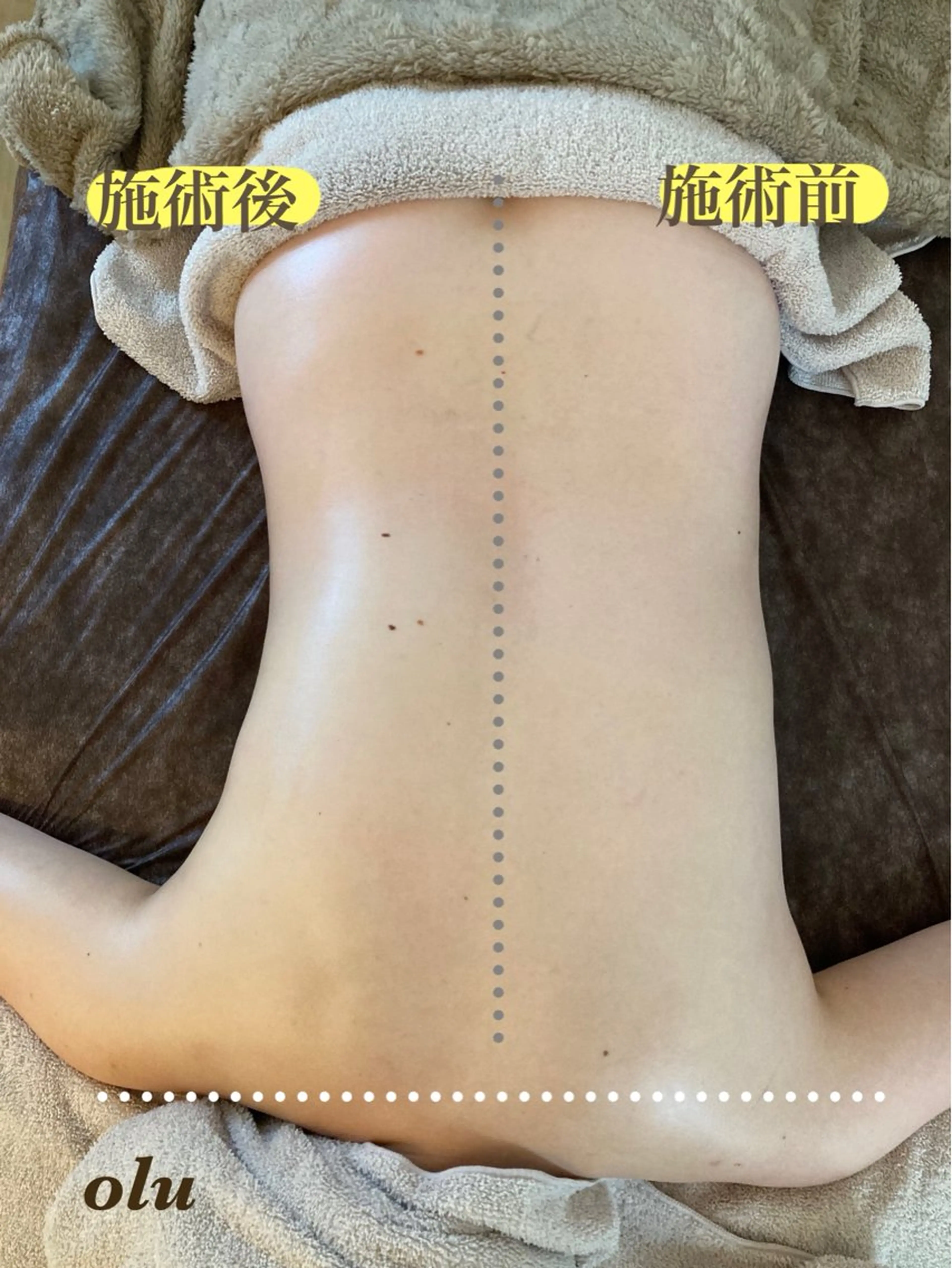 肩首のコリ、腰痛が気になる方へ⭐︎アロマトリートメント背面ケア30分の写真