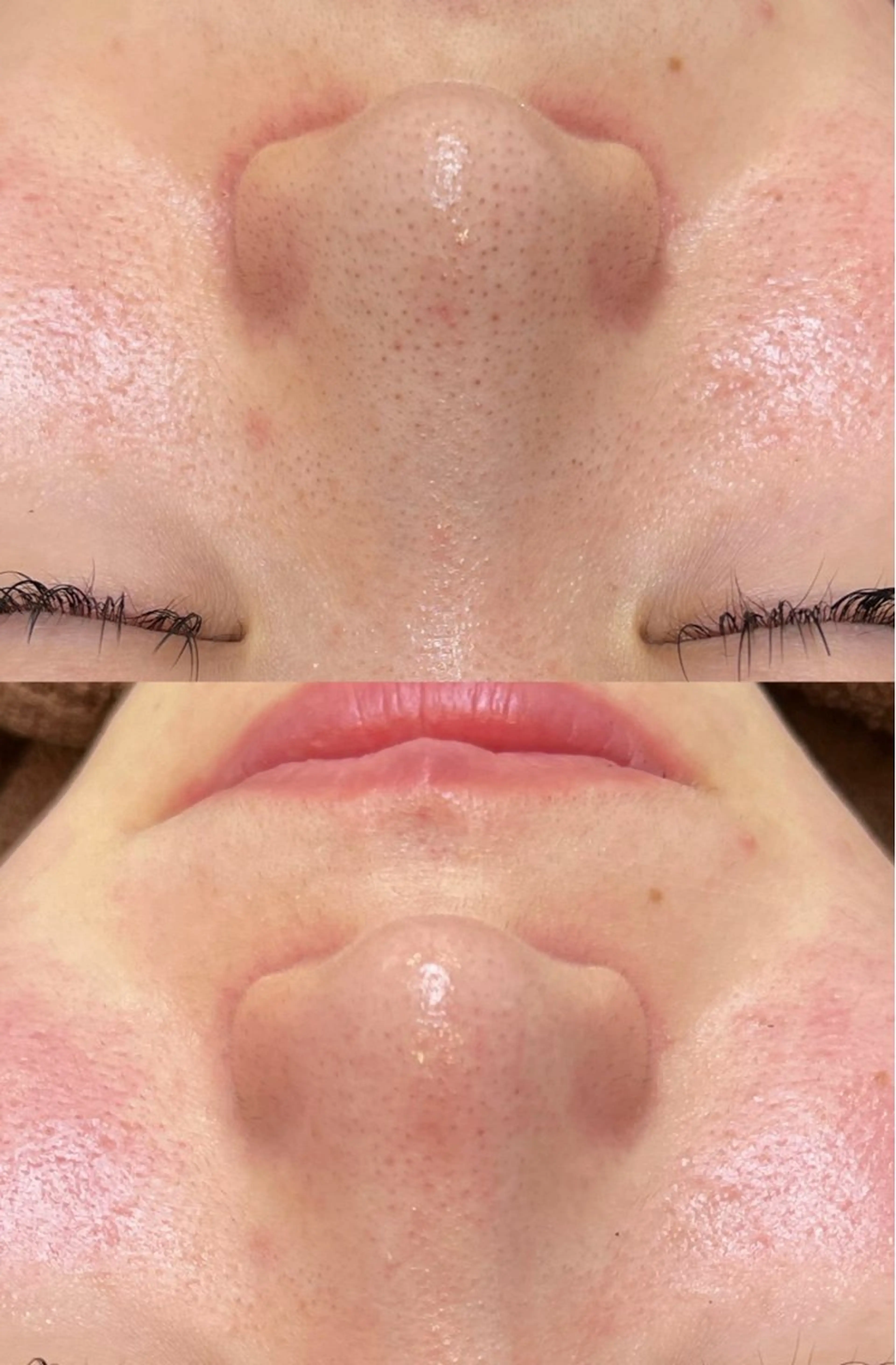 エステ プライベートサロン リプレイスのエステ・リラクイメージ