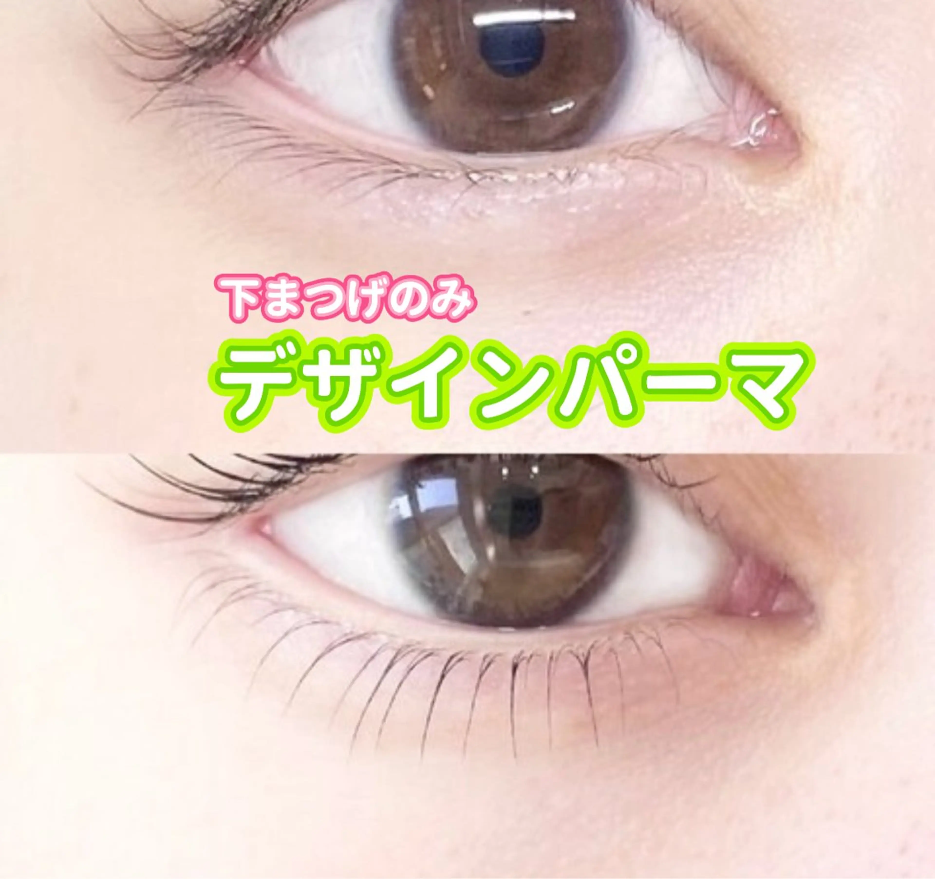 【下まつげパーマ】逆さまつげ改善！中顔面短縮¥6000の写真