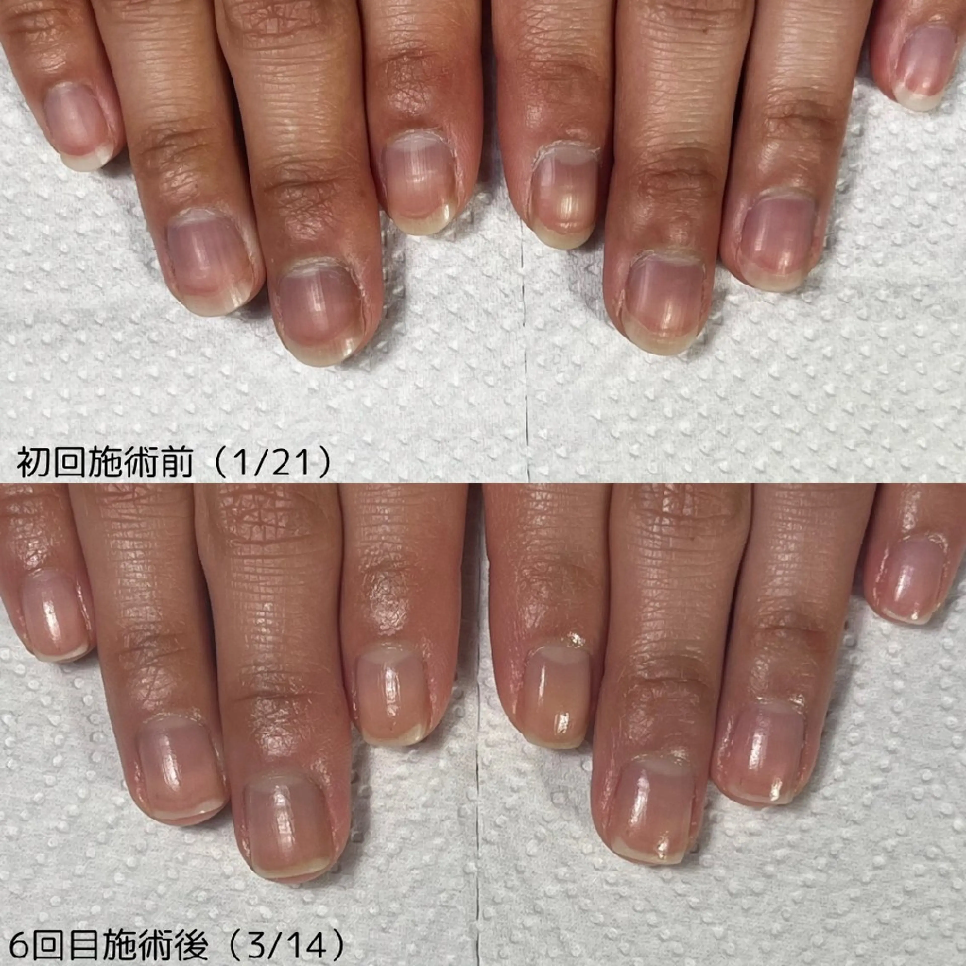 ネイル nail 1623のネイルデザイン