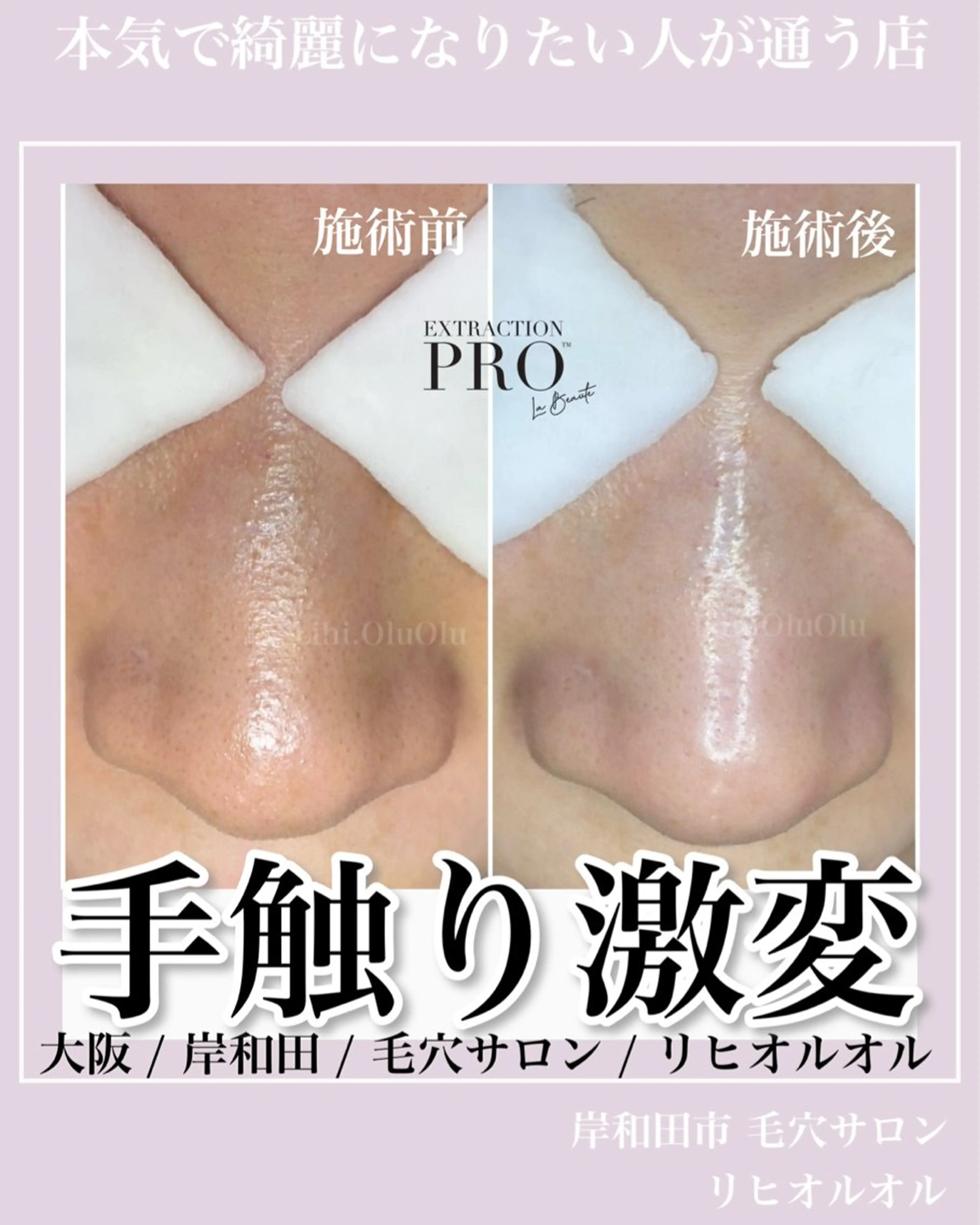 エステ 毛穴汚れ改善専門店/ 岸和田/リヒオルオルのエステ・リラクイメージ