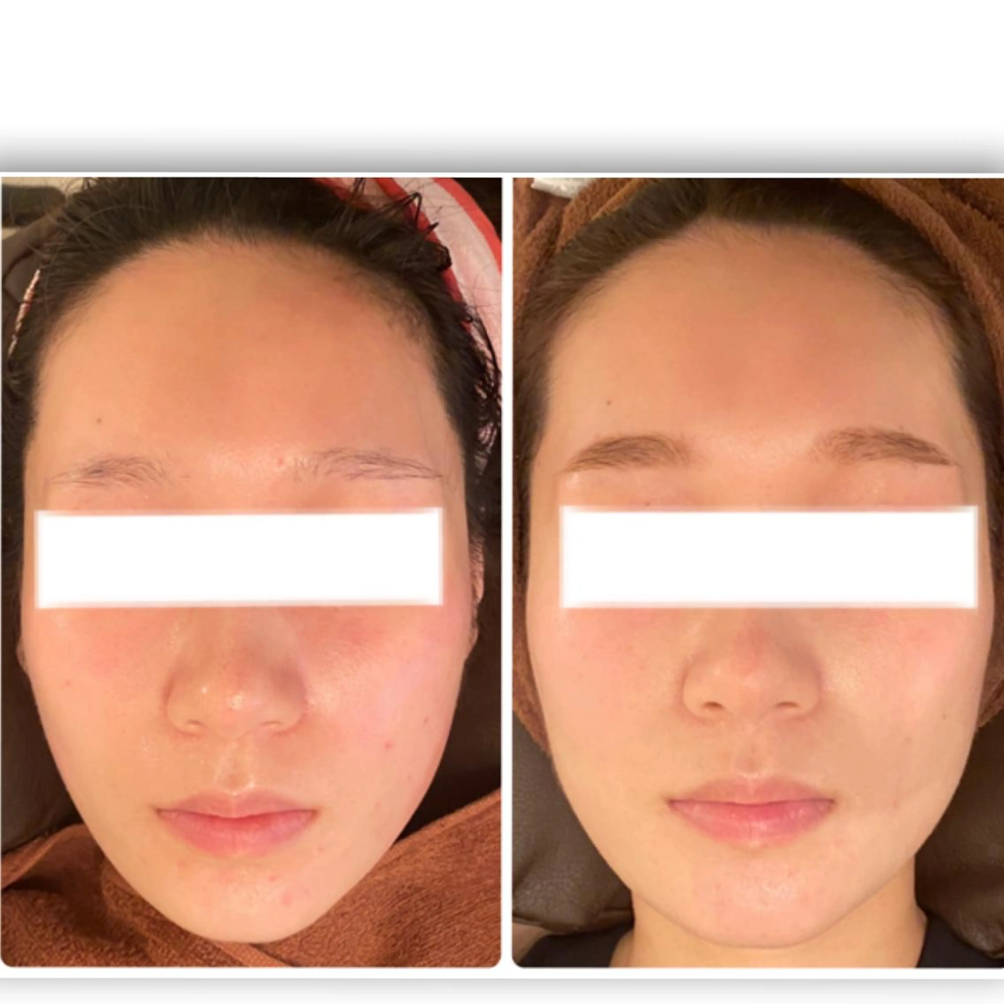 FLEUR大阪・整体 ・ハイフ・痩身・小顔のエステ・リラクイメージ