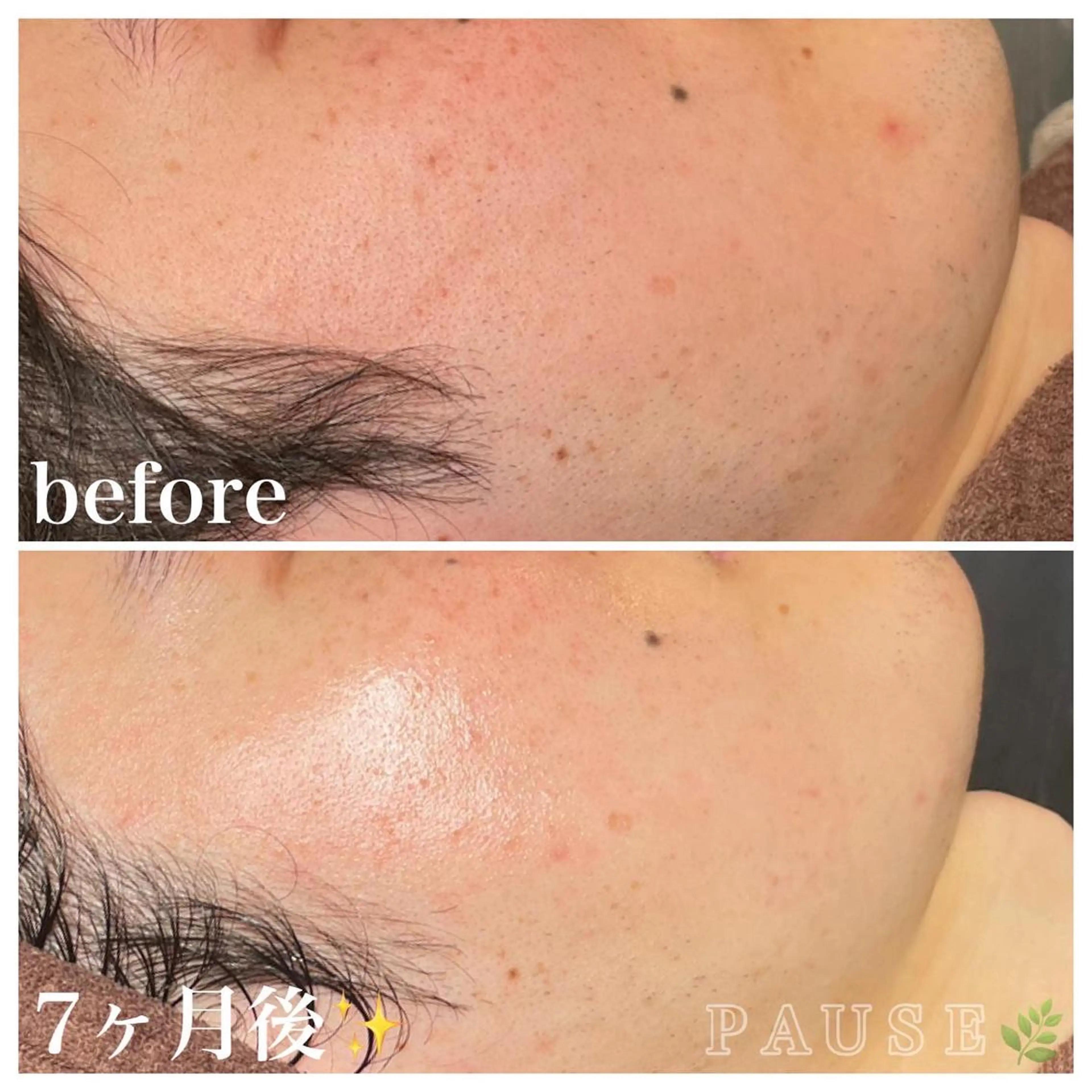 エステ 浜野 恵美のエステ・リラクイメージ