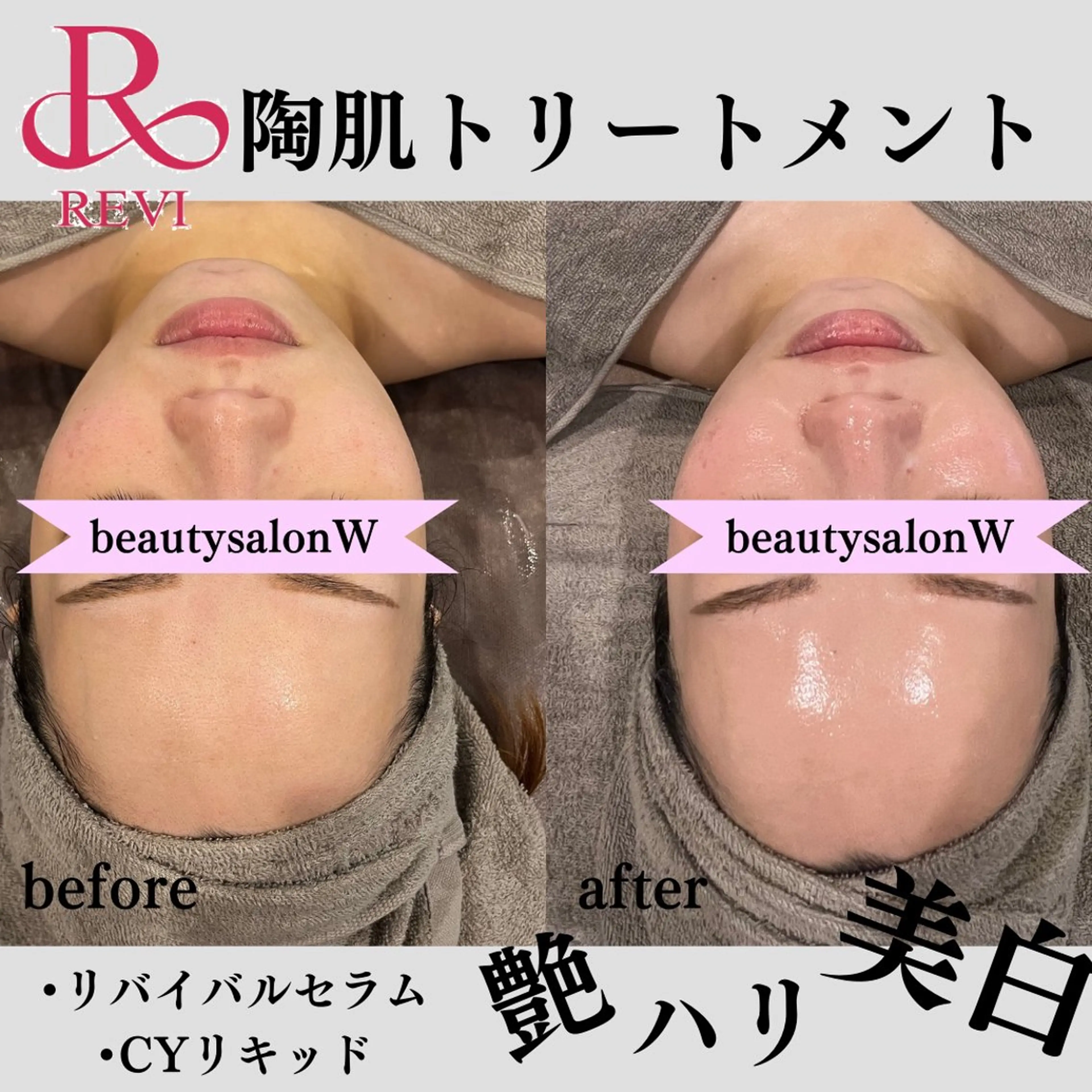 エステ リラク beautysalonW所属・beauty salonWのエステ・リラクイメージ