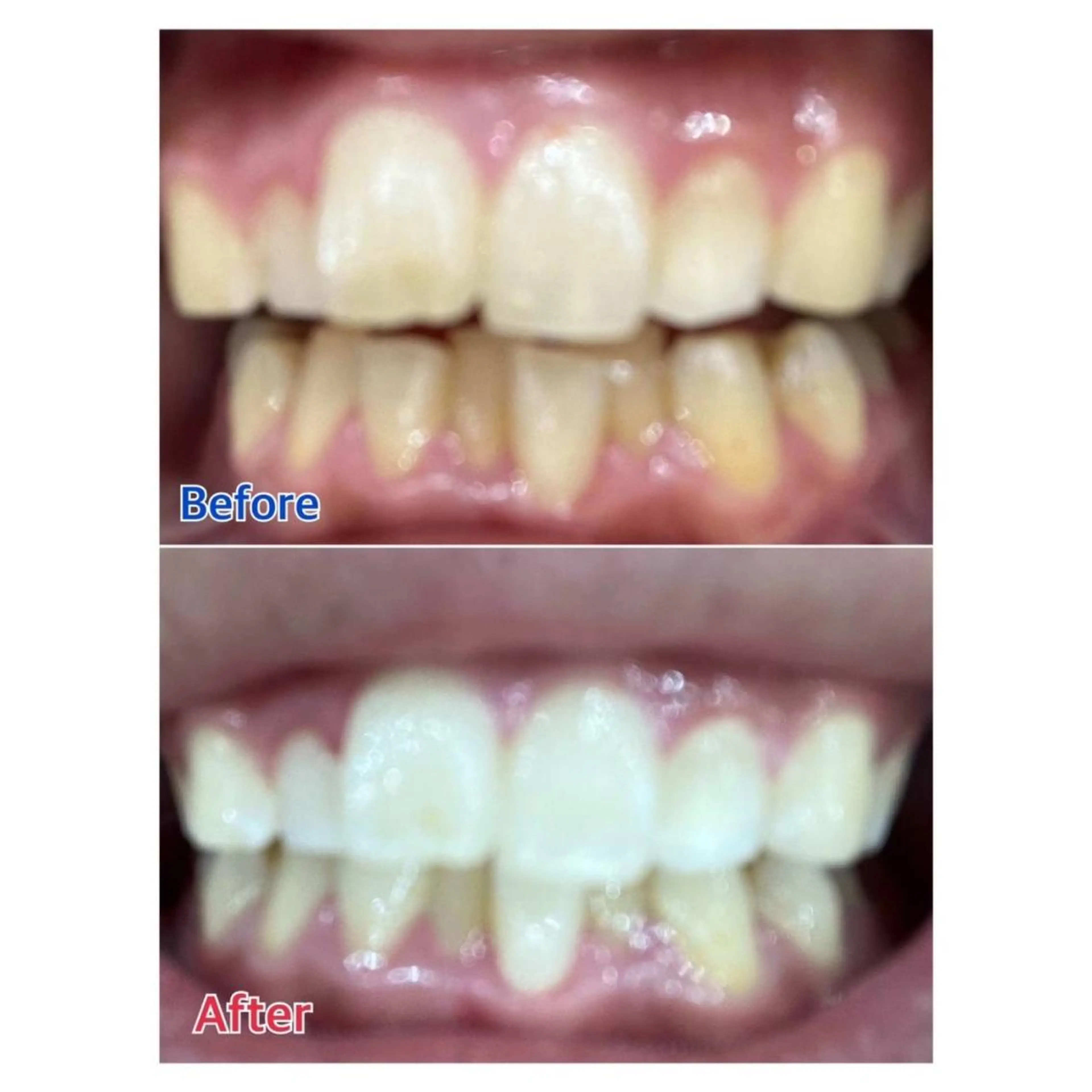 MBEAUTYSALON 千葉店・京成大久保所属・Melty 輝のその他イメージ