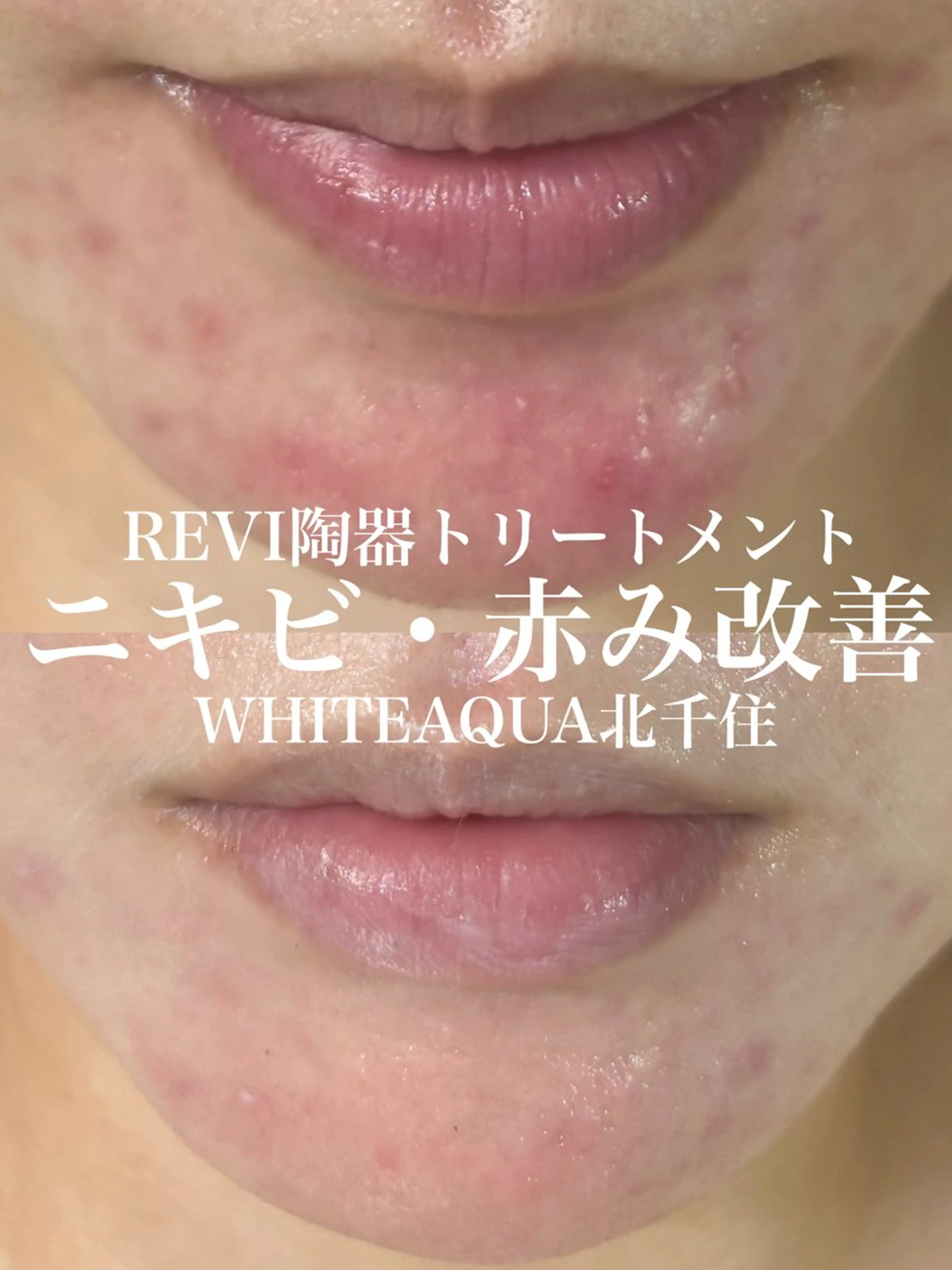 WHITE AQUA 北千住店のエステ・リラクイメージ