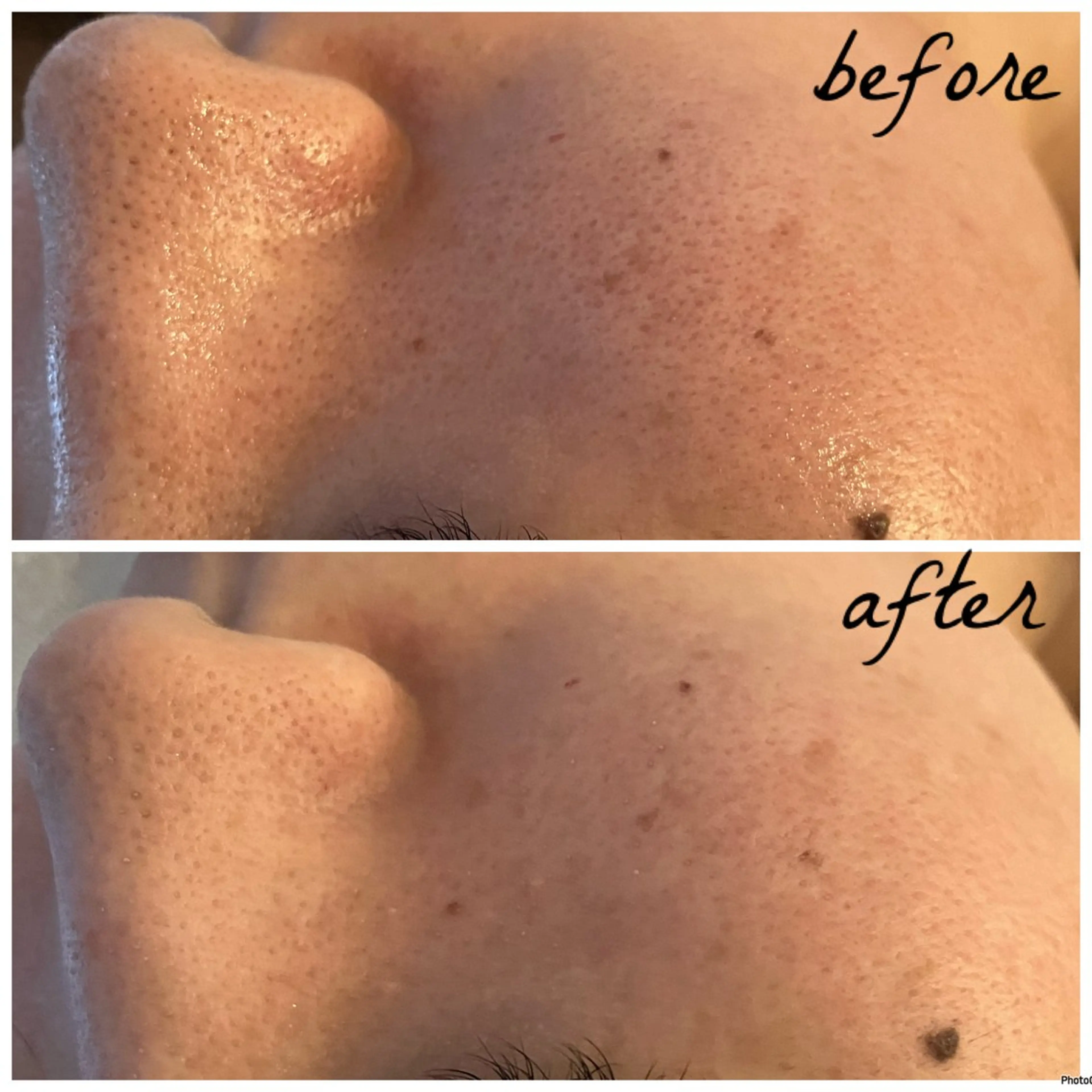 メンズ メナード岐阜茜部 杉浦のエステ・リラクイメージ