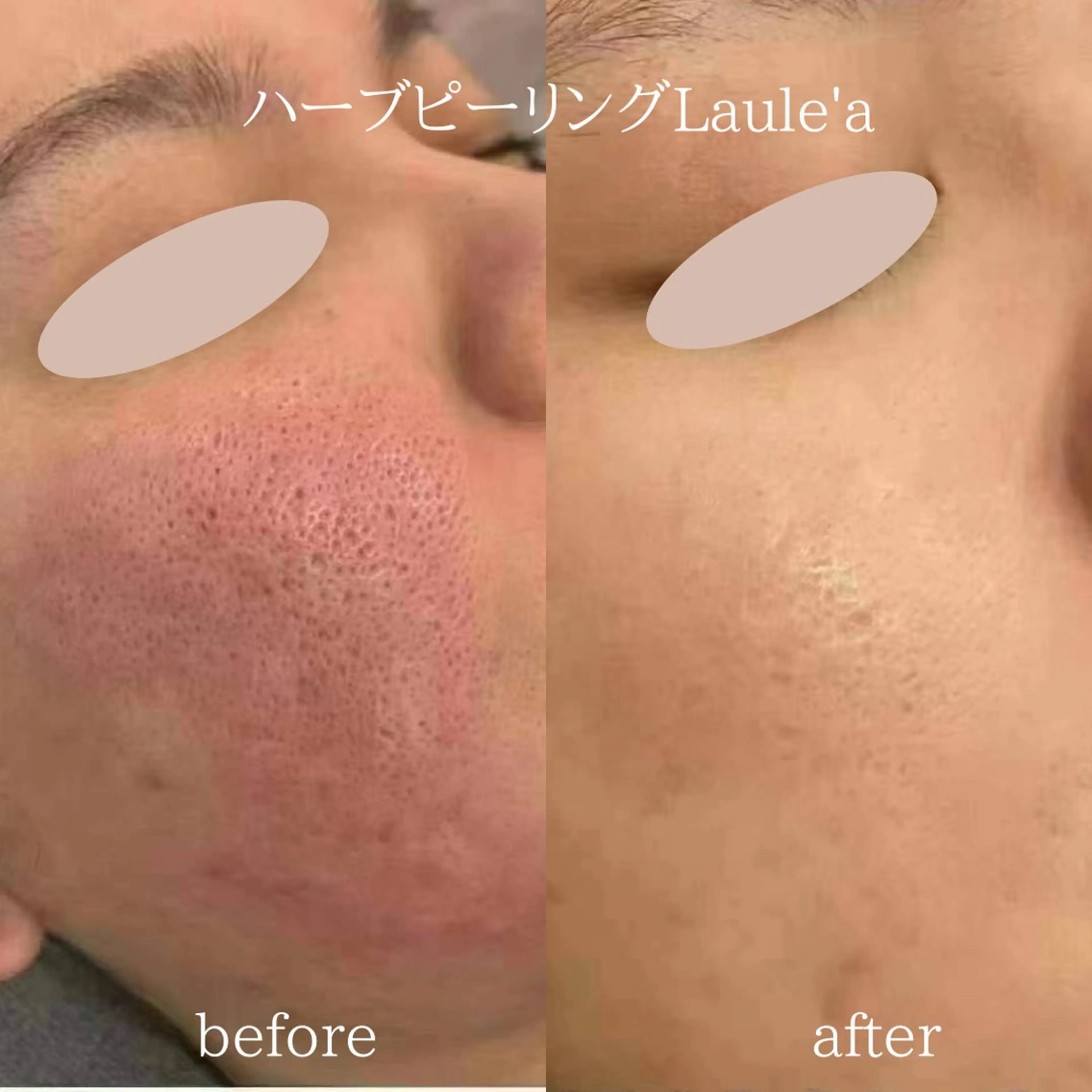 痩身/腸もみ/ ヘッドスパ/リンパのエステ・リラクイメージ