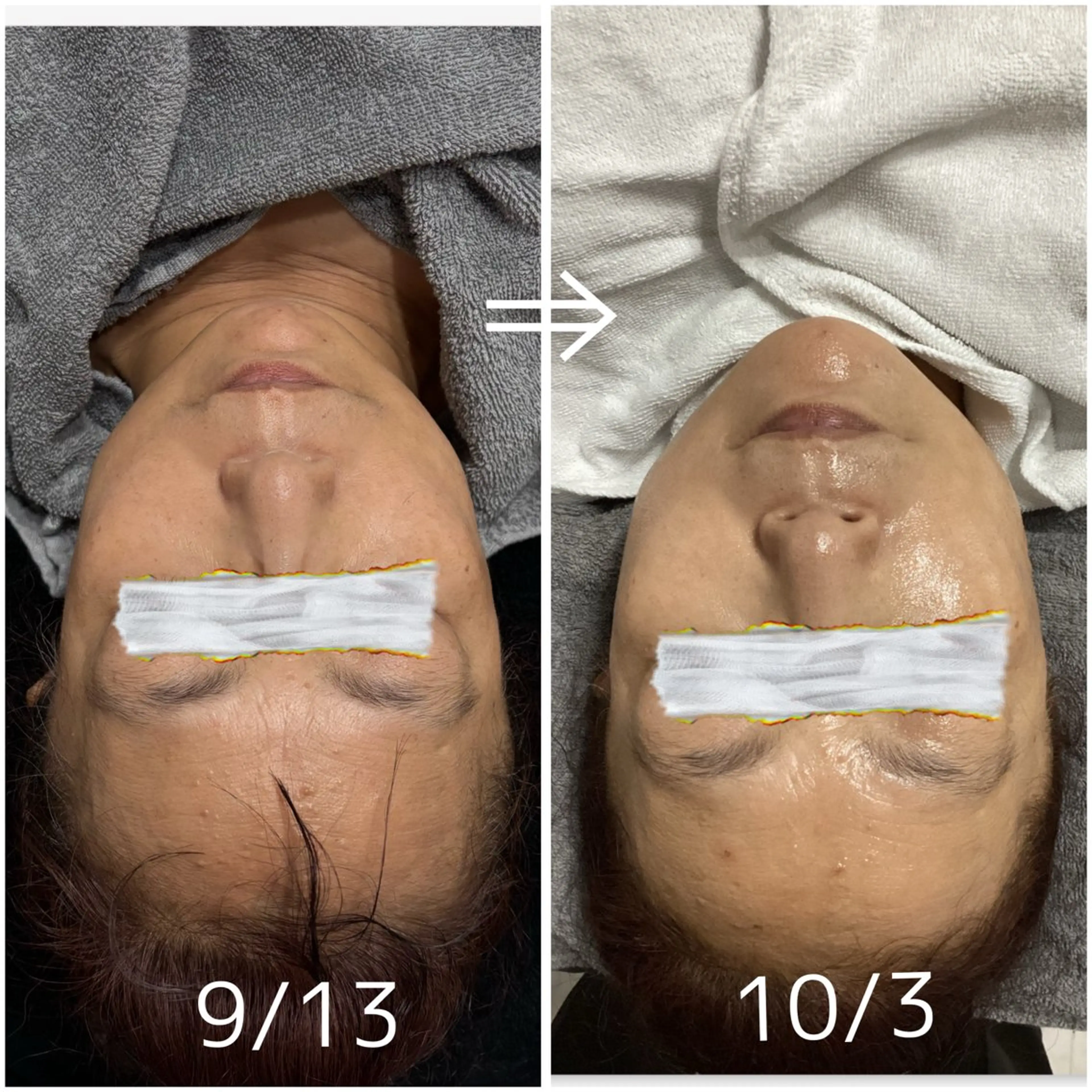 肌質改善サロン🌕 ⠀【ルーナピエナ】のエステ・リラクイメージ