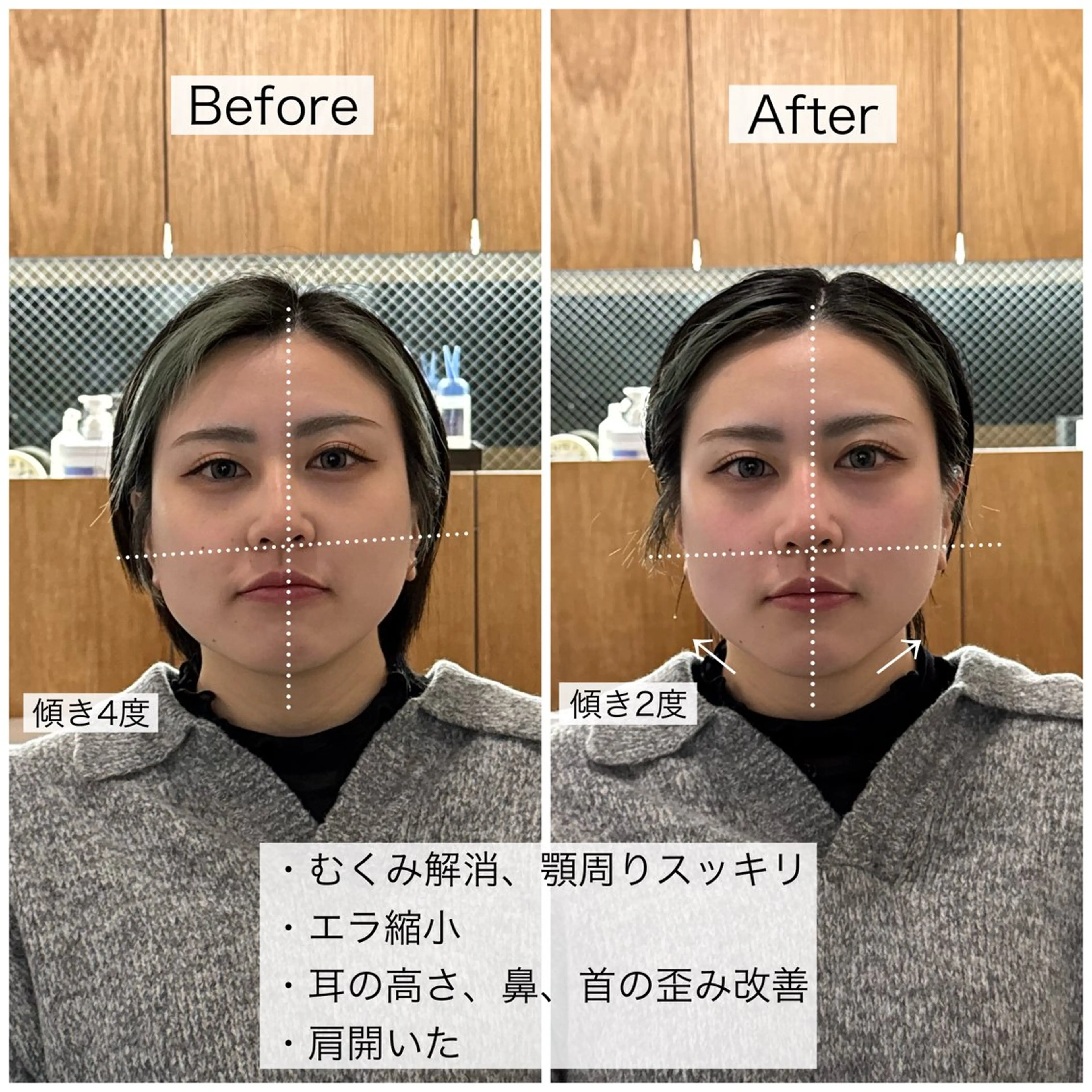 頭皮クレンジング+整顔スパ(シャンプーブロー込み)の写真