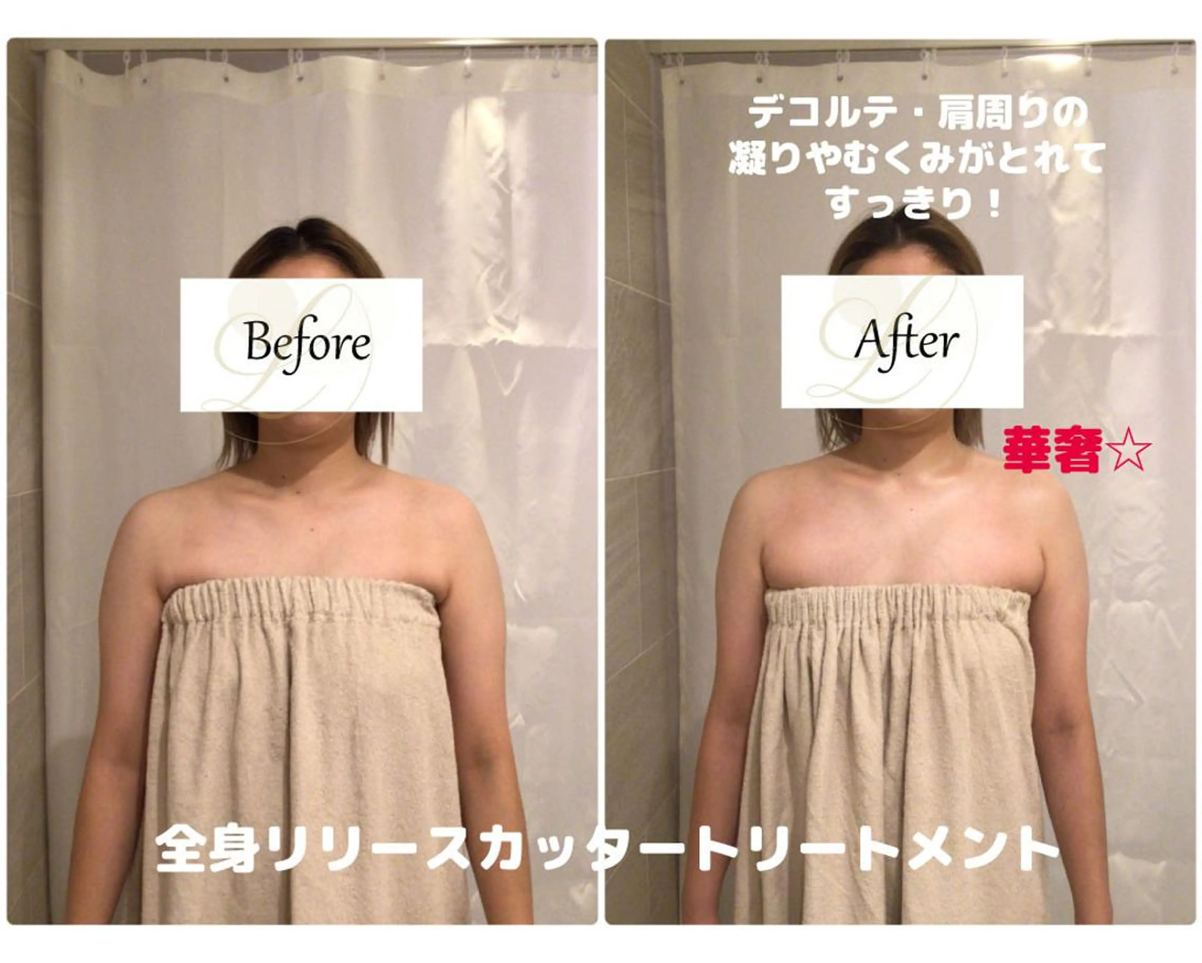 肩こり改善 筋膜リリースカッターのエステ・リラクイメージ