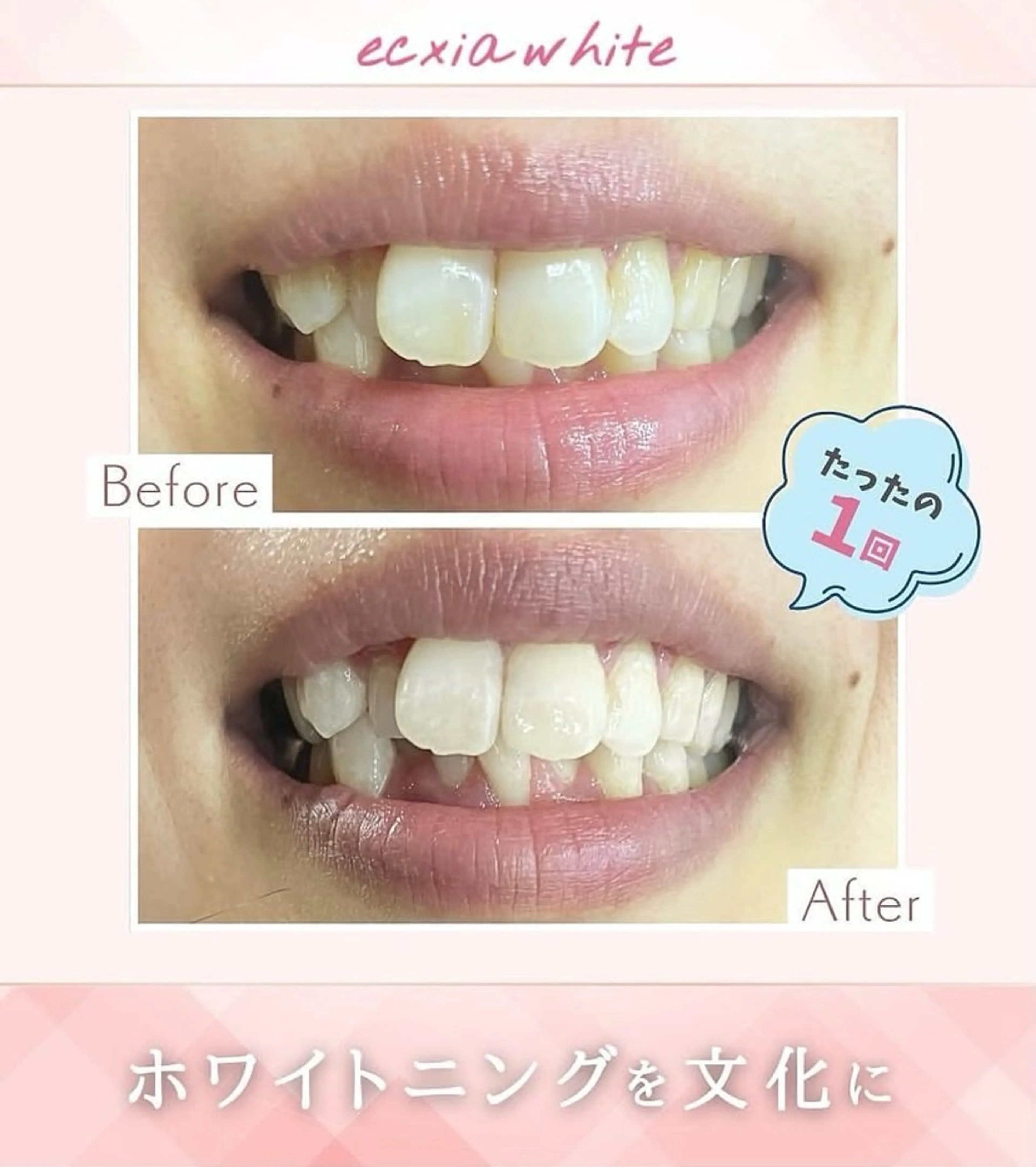 その他 エクシアホワイトニング草津店所属・nanami -ホワイトニングのその他イメージ