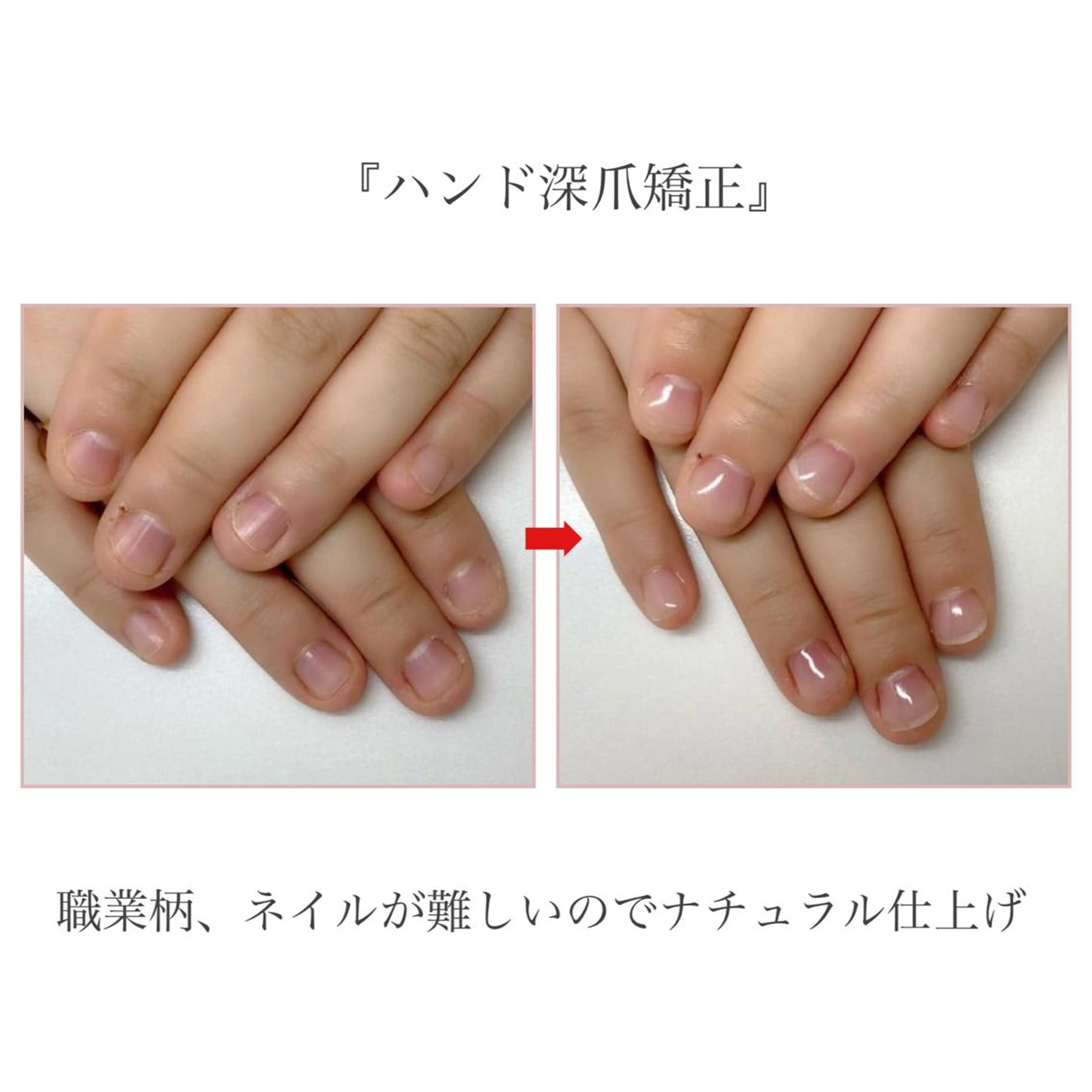 【ネイルNGなお仕事の方へ✨】自爪風◎クリア×長さだし10本《初回限定》の写真