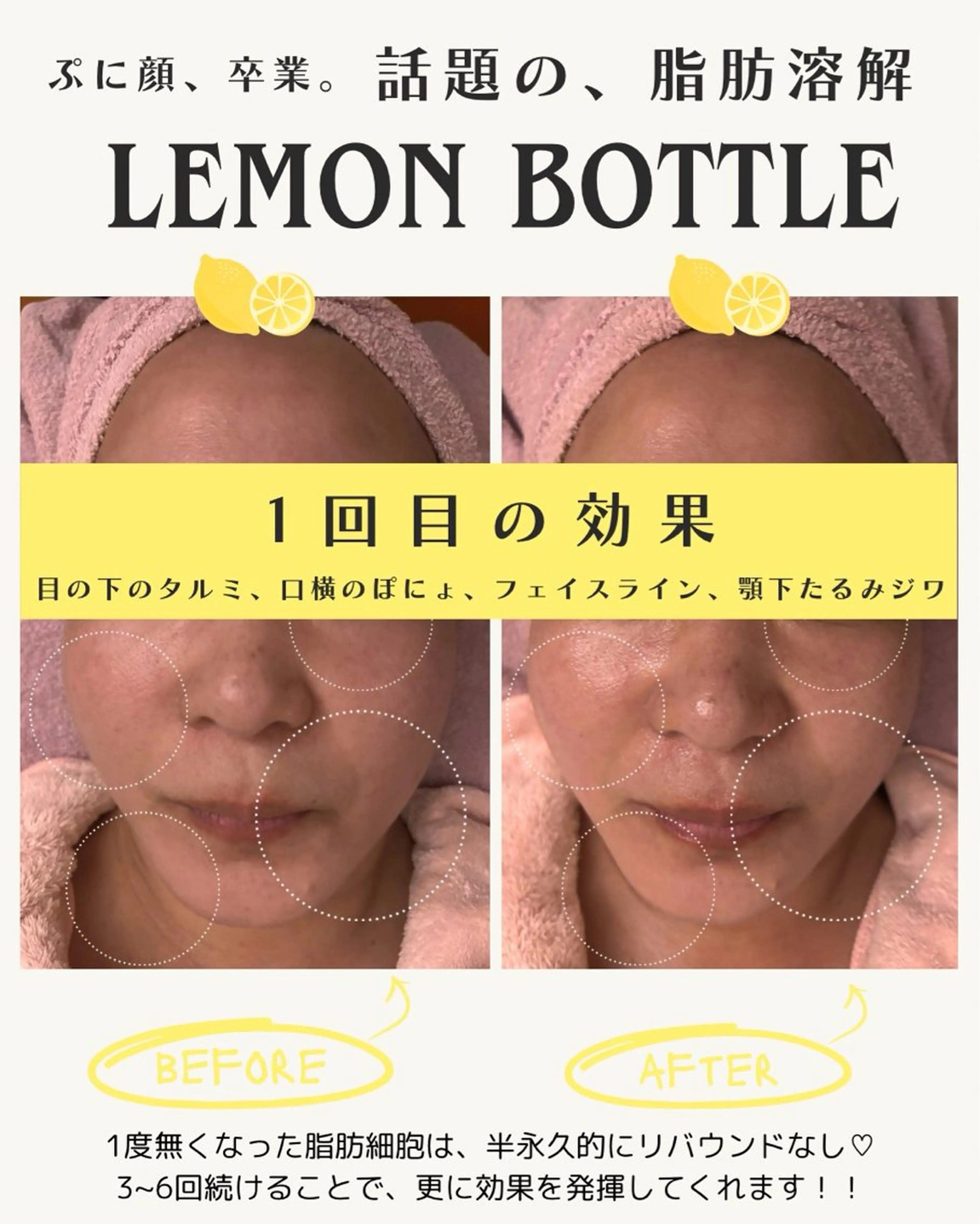 ell 東大阪所属・🎀BiBi韓国美容 コスパ強！美活サロンのエステ・リラクイメージ