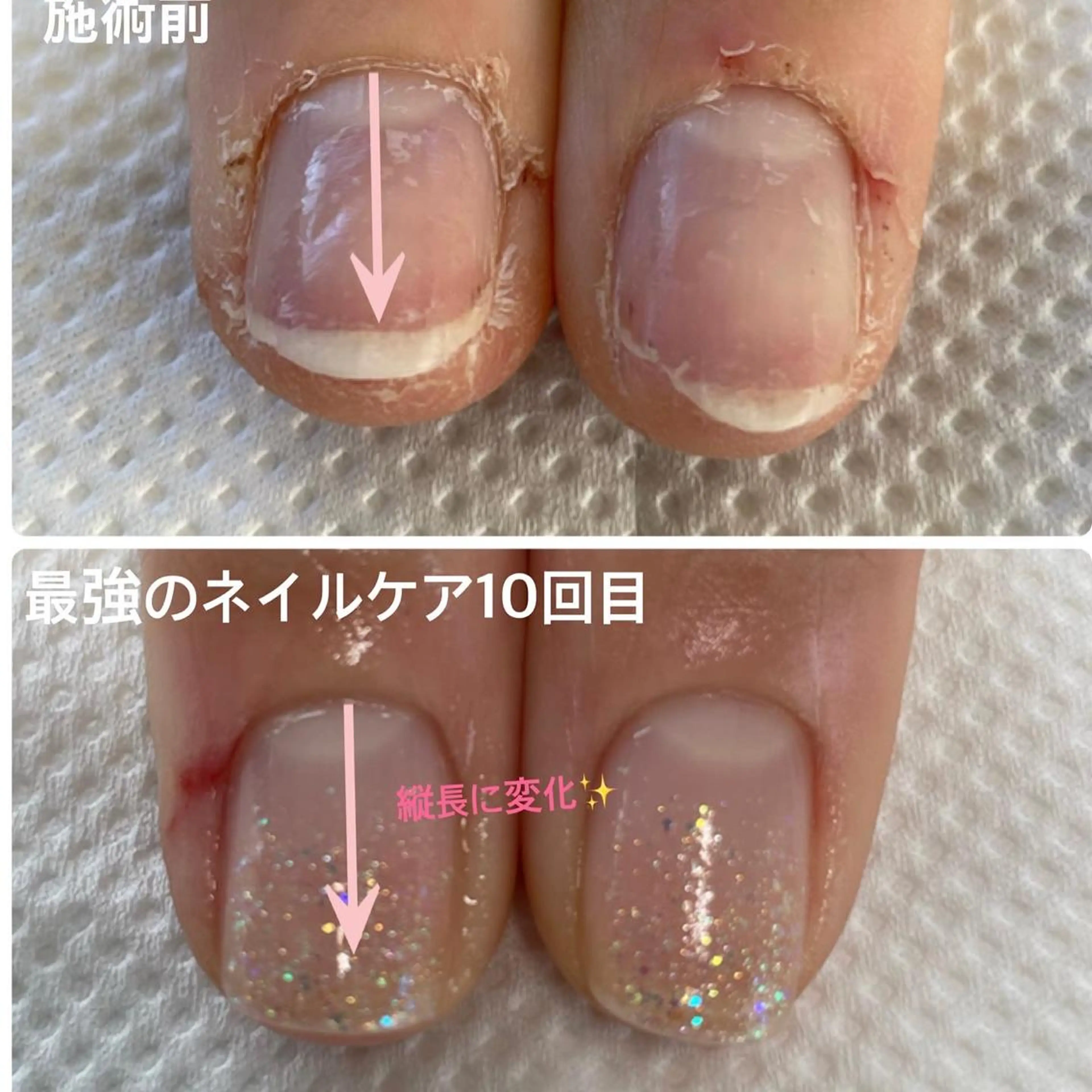 ネイル 橋本 理絵のネイルデザイン