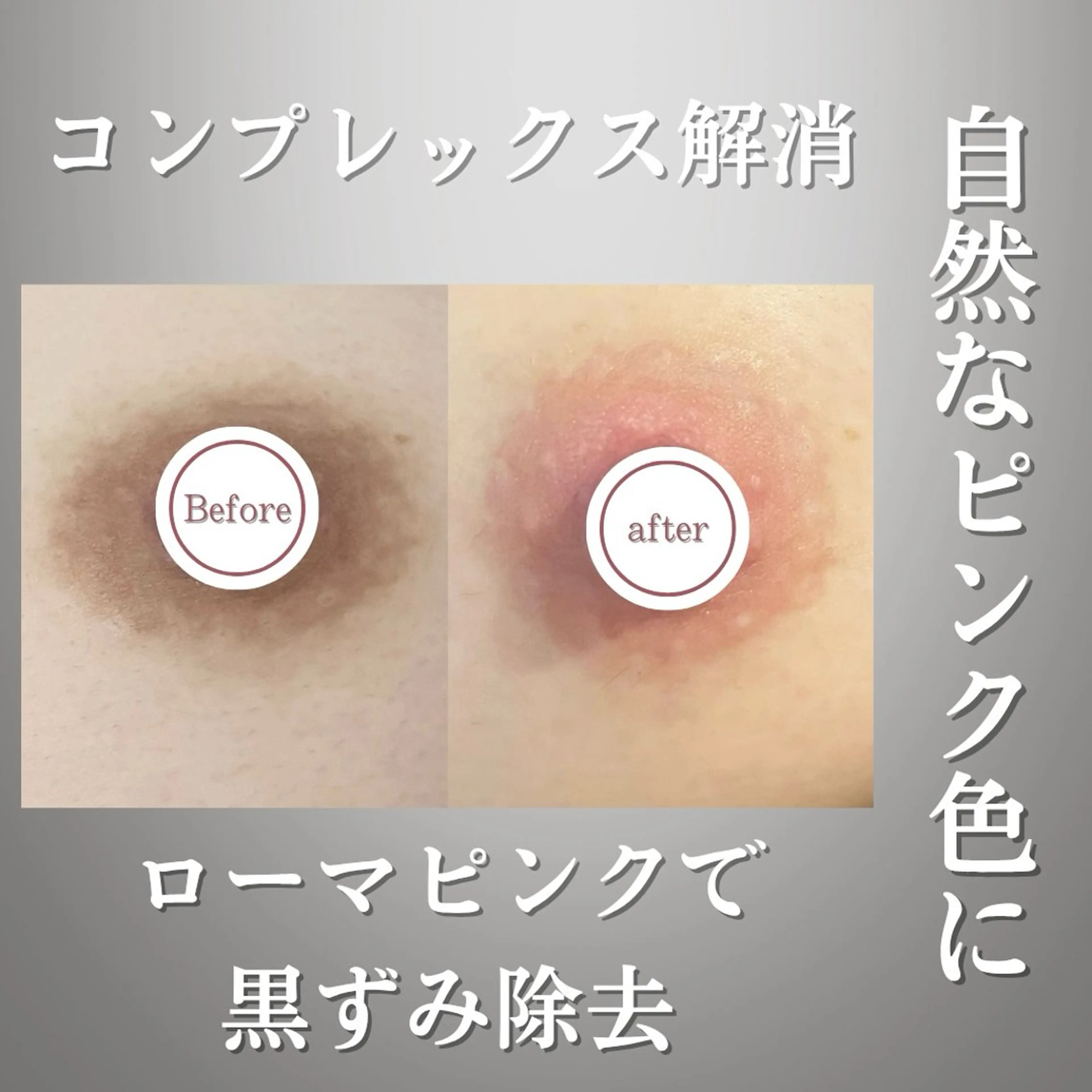 川越ローマピンク 光脱毛＆ワックス脱毛のエステ・リラクイメージ