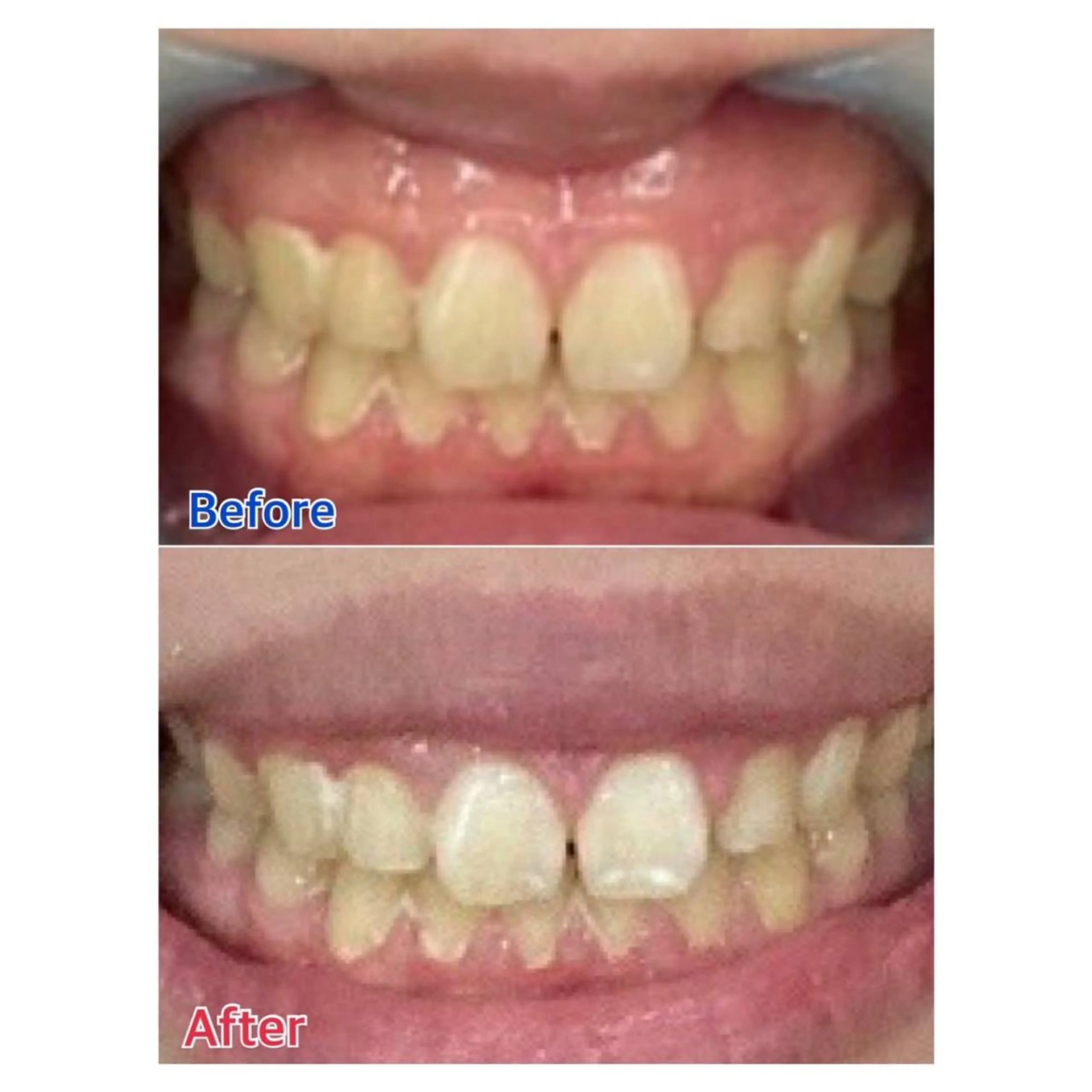 MBEAUTYSALON 千葉店・京成大久保所属・Melty 輝のその他イメージ