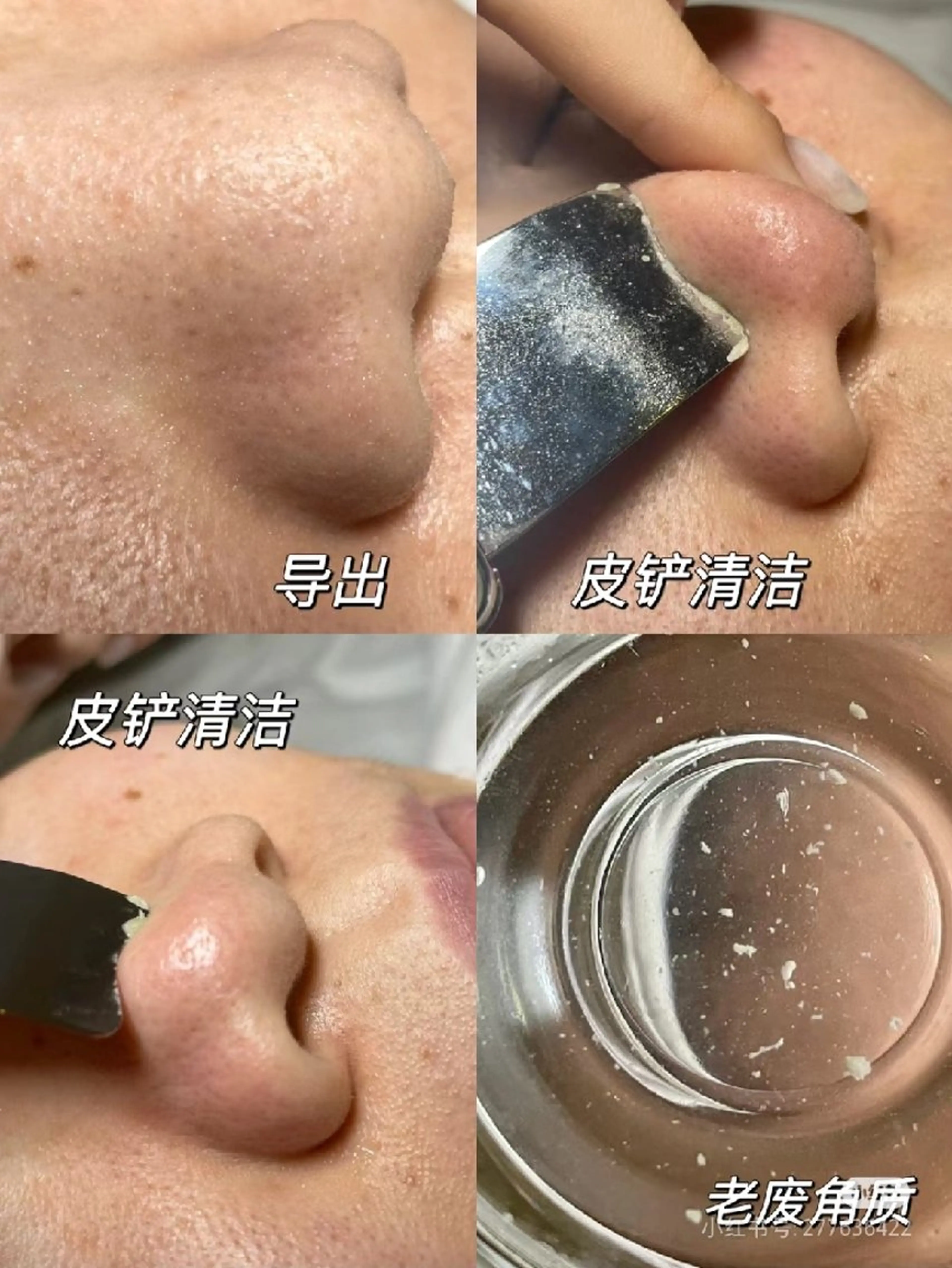 Healing Space  Easen所属・Healing Easenのエステ・リラクイメージ