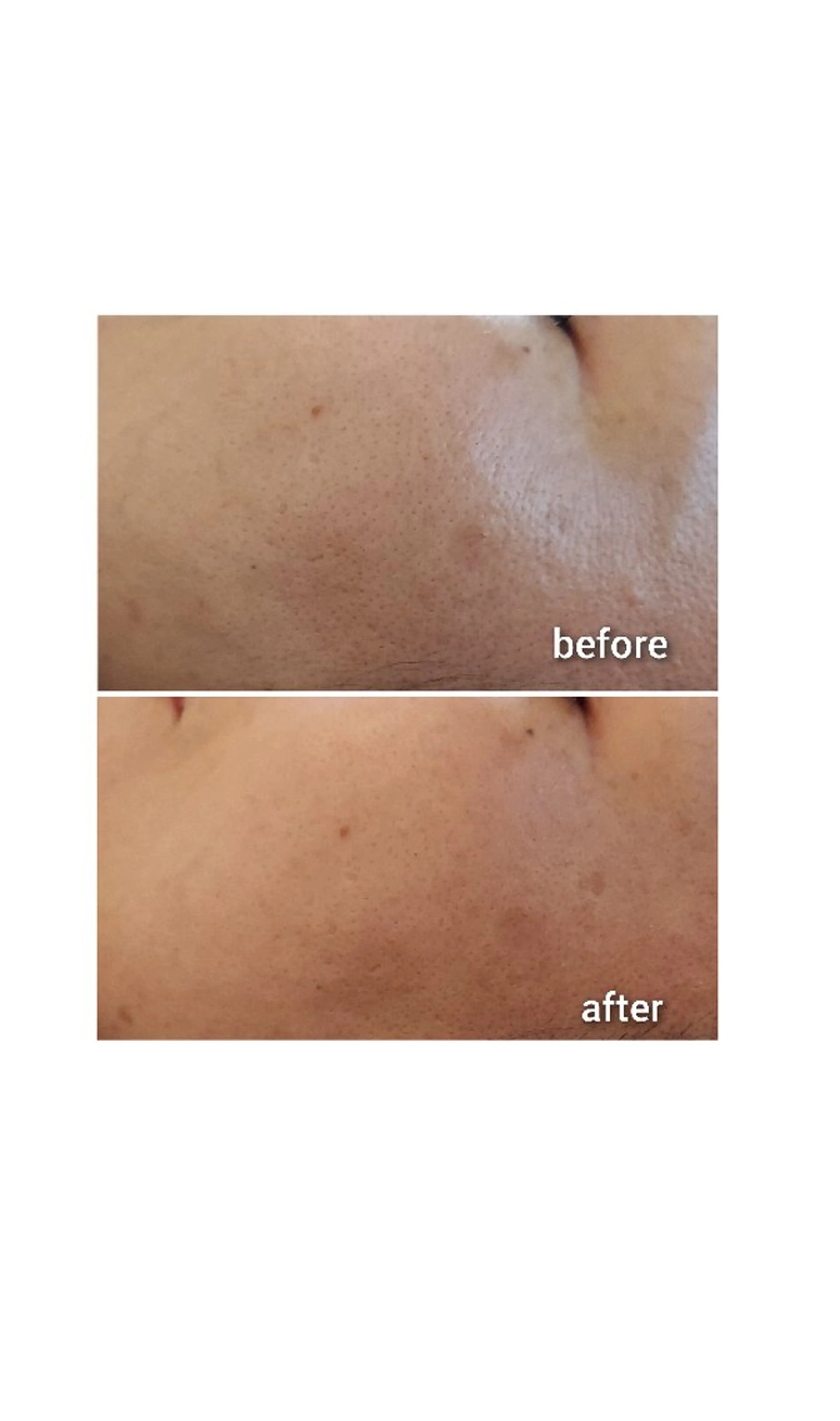 エステ Nail salon  Kayleeのエステ・リラクイメージ