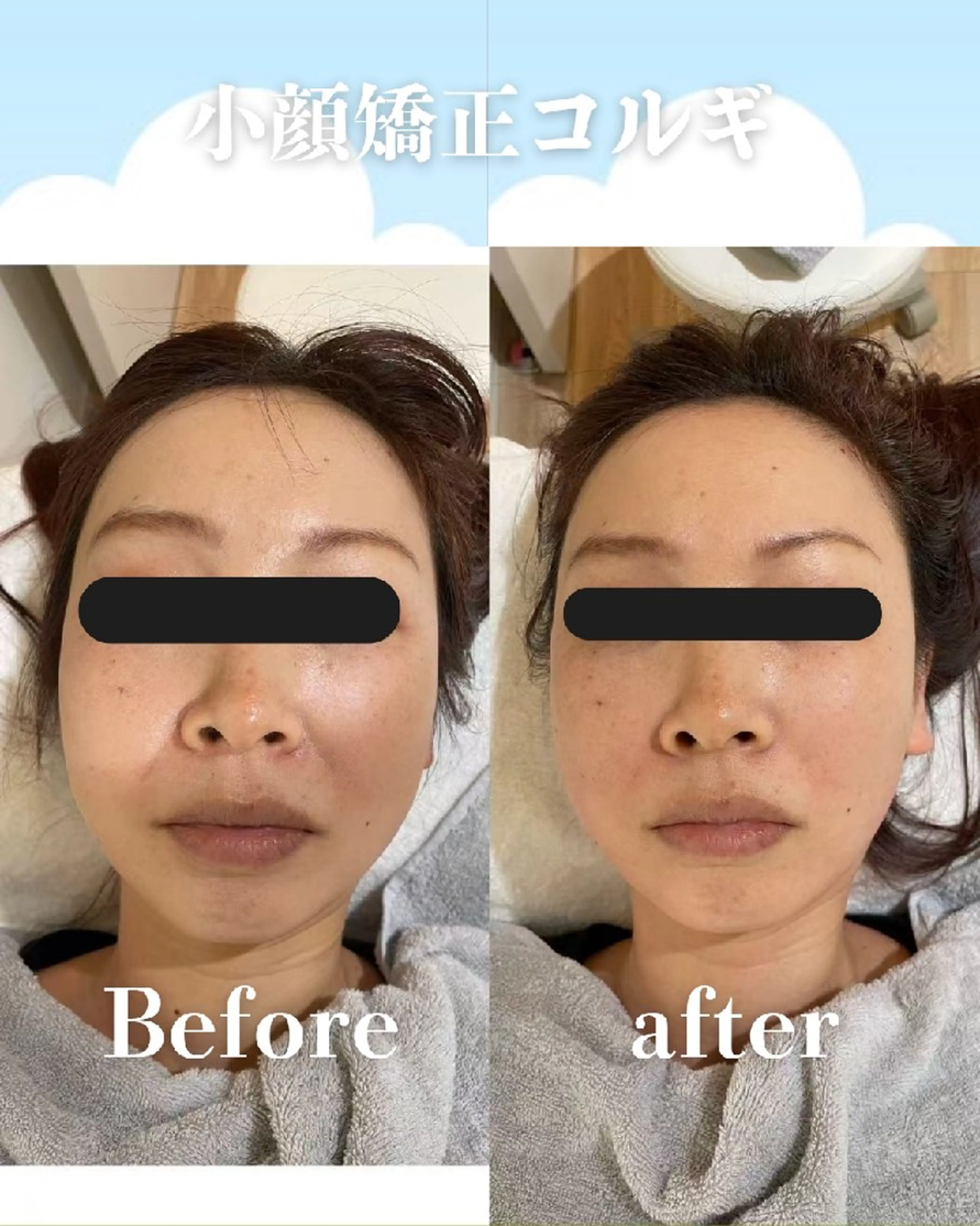 エステ リラク 高岳/久屋大通 脱毛 コルギ🌿ENSHIのエステ・リラクイメージ