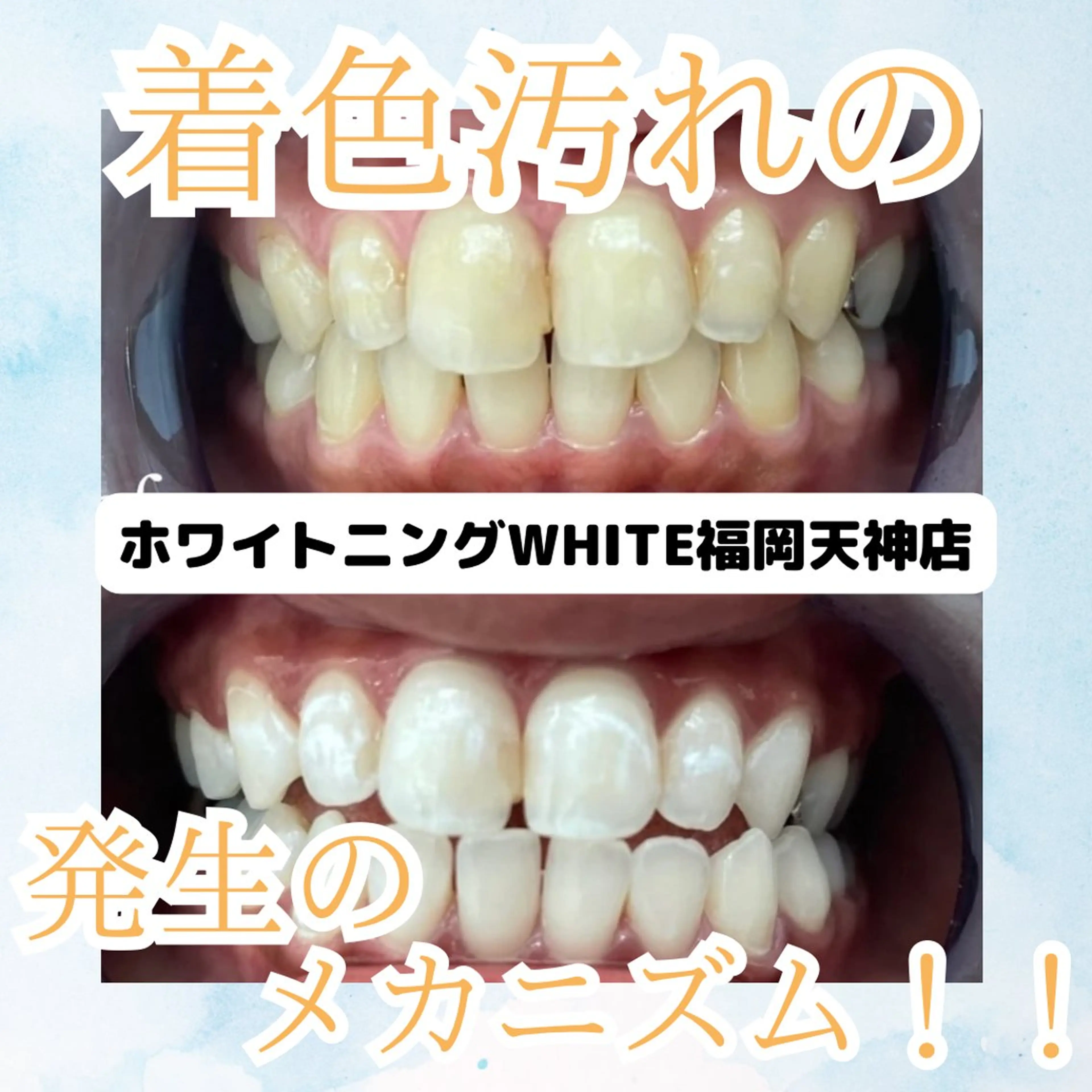 メンズ 撮影モデル ホワイトニング専門店 WHITE天神店のエステ・リラクイメージ