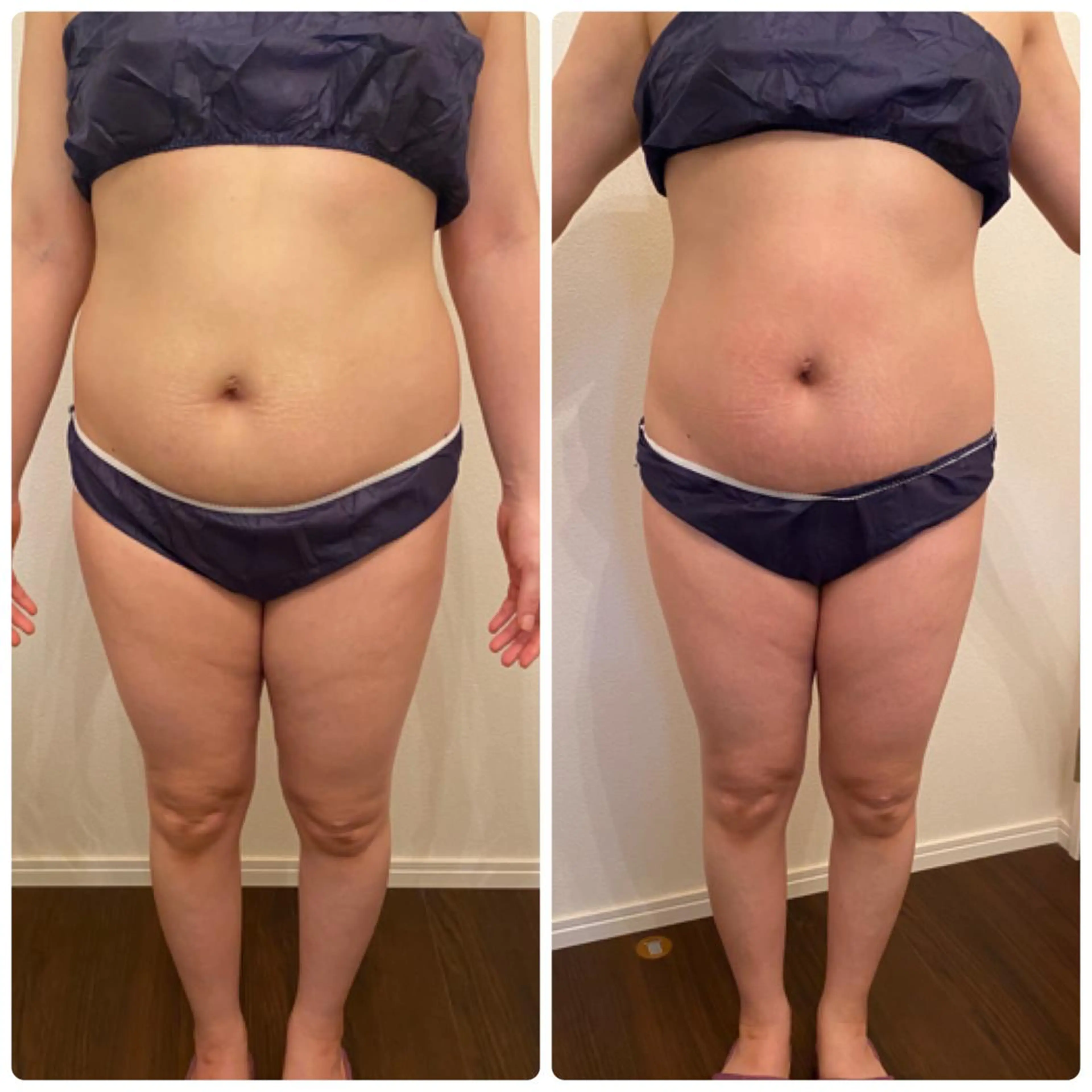 FLEUR大阪・整体 ・ハイフ・痩身・小顔のエステ・リラクイメージ