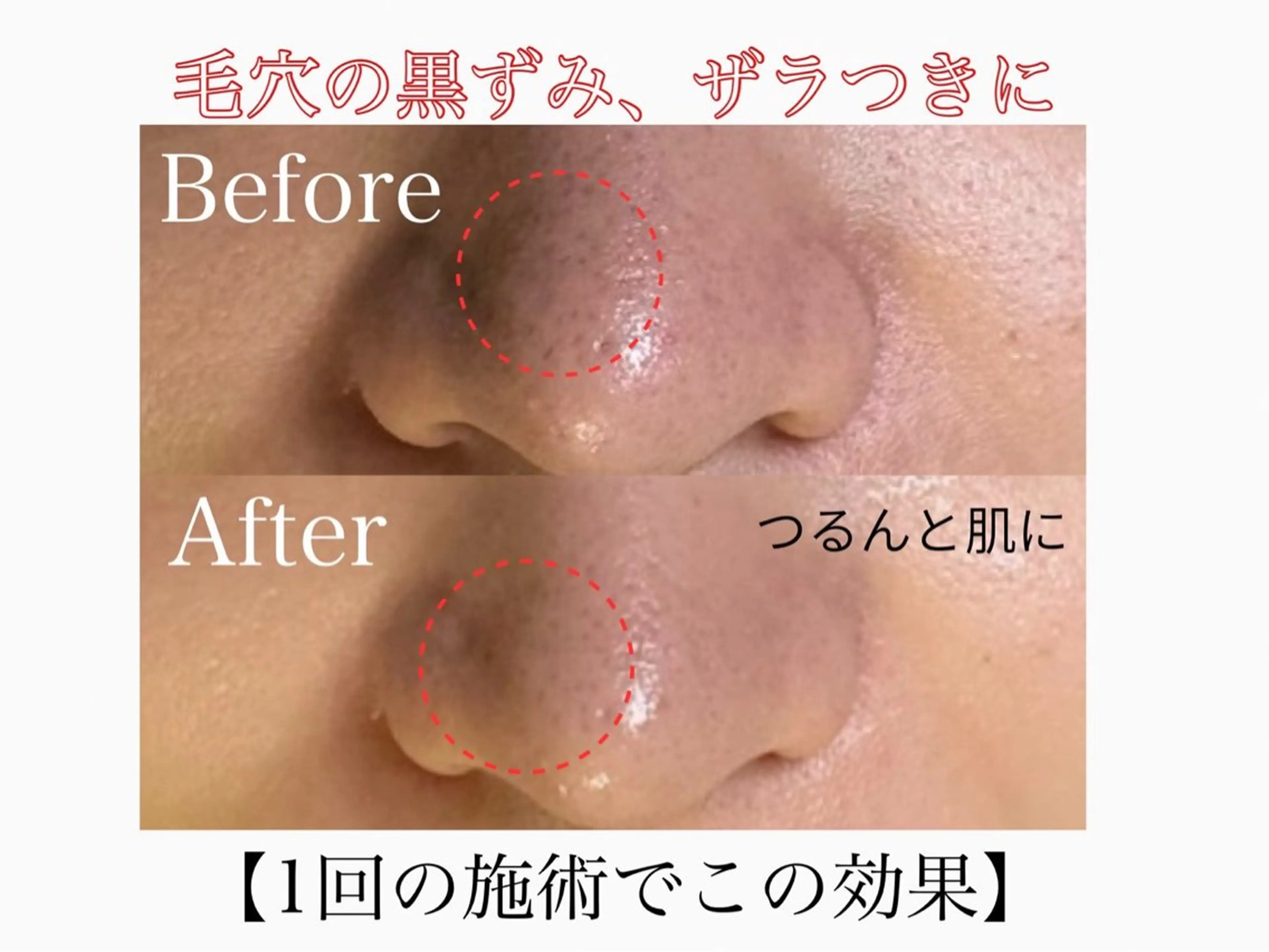 エステ 🌸🧡六本木 脱毛しずか🧡🫧の眉毛・アイブロウイメージ