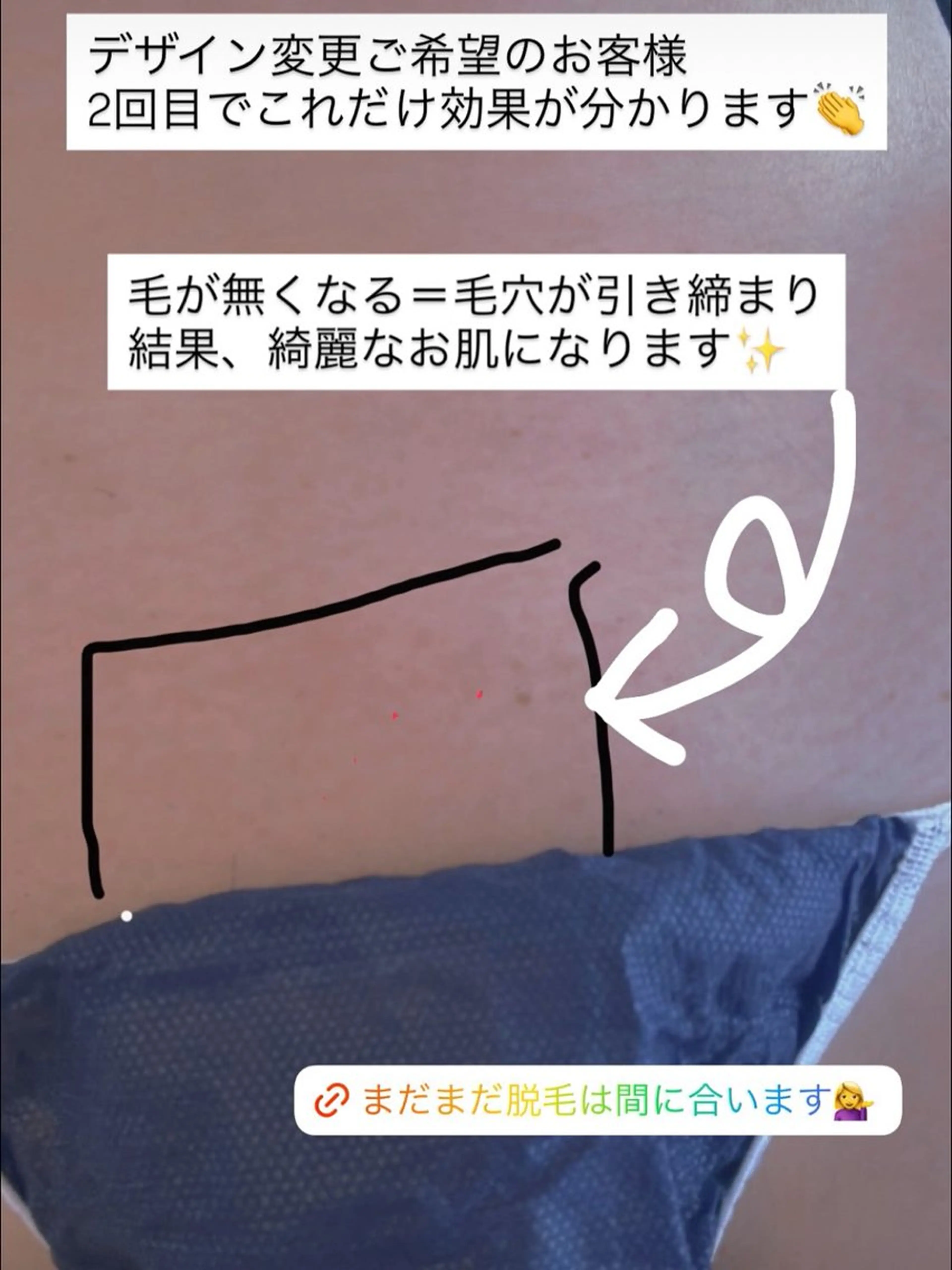 Beauty salon Wish所属・Wish めぐみのエステ・リラクイメージ