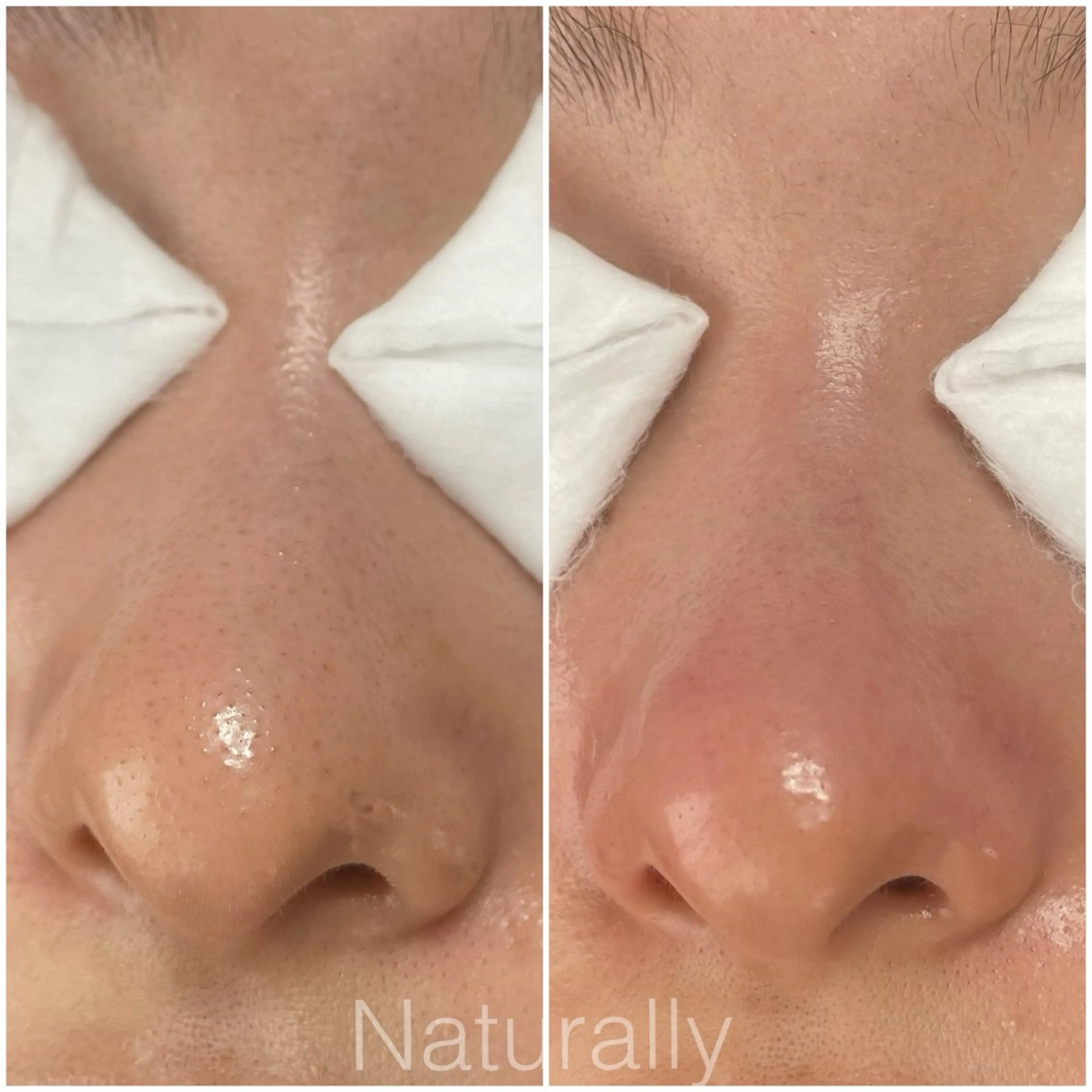 Naturally ナチュラリーのマツエク・マツパデザイン