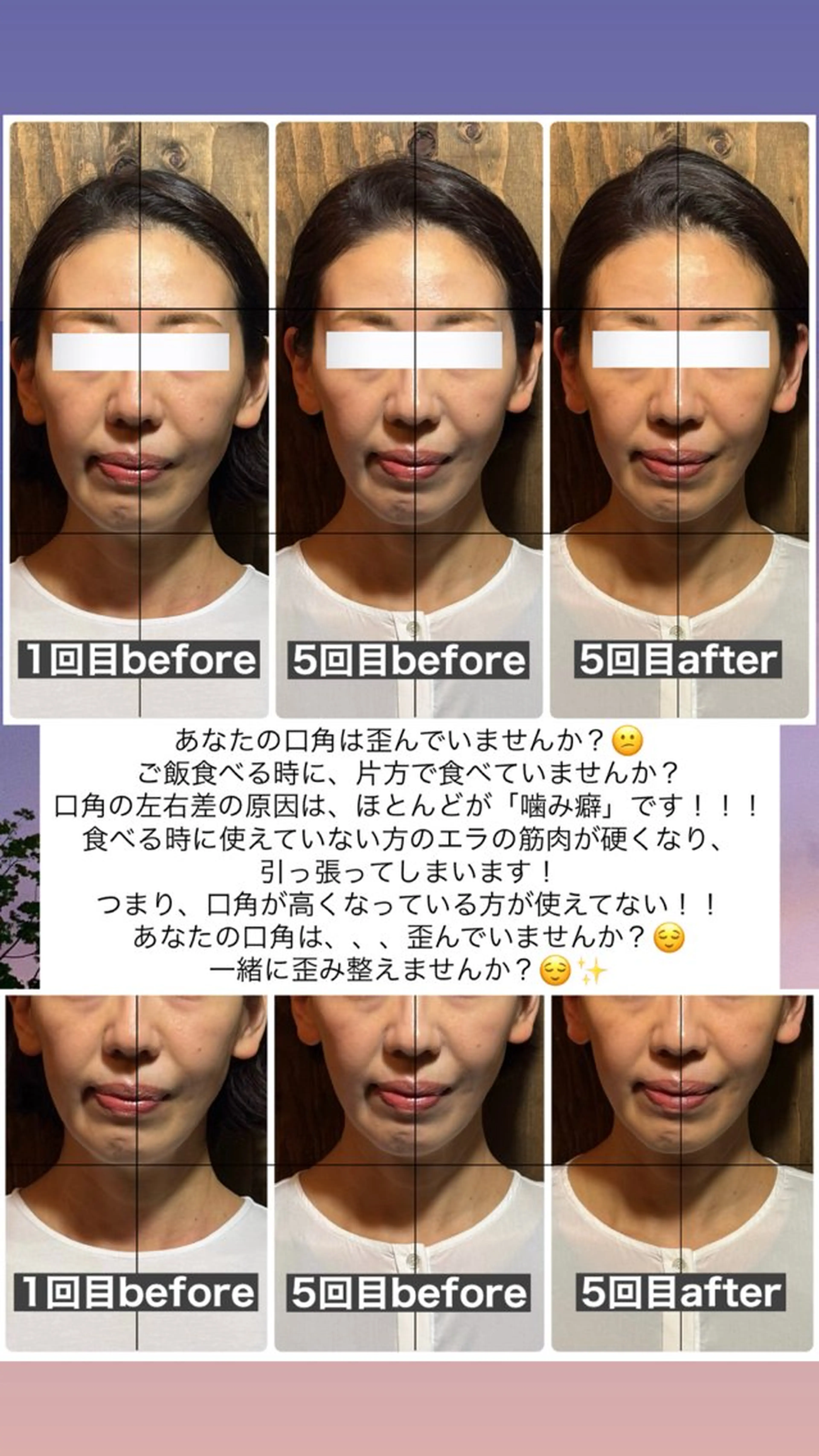 エステ リラク 💎後悔させない小顔 矯正💎イトヤマ🌱のエステ・リラクイメージ