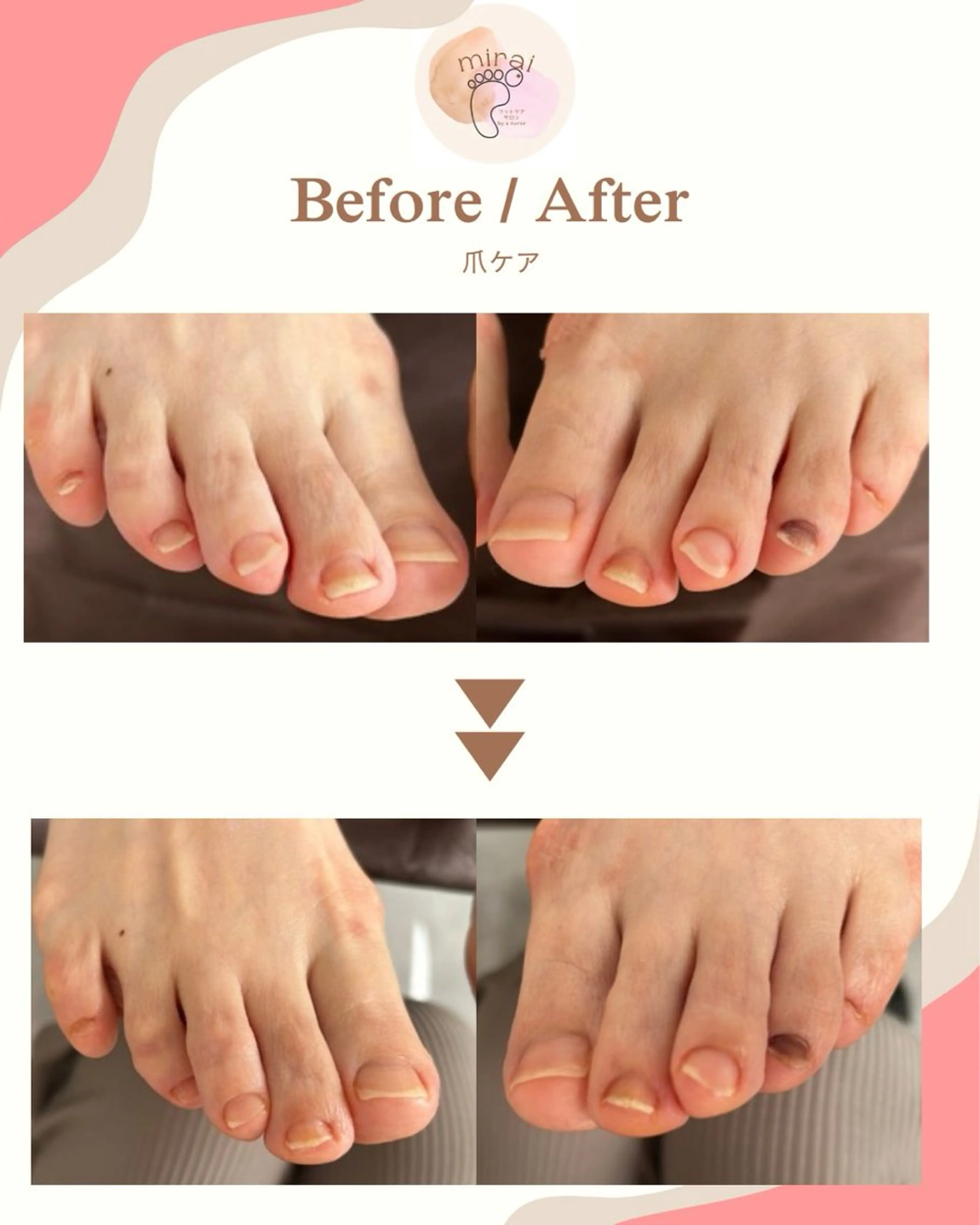 その他 フットケアサロン miraiのその他イメージ