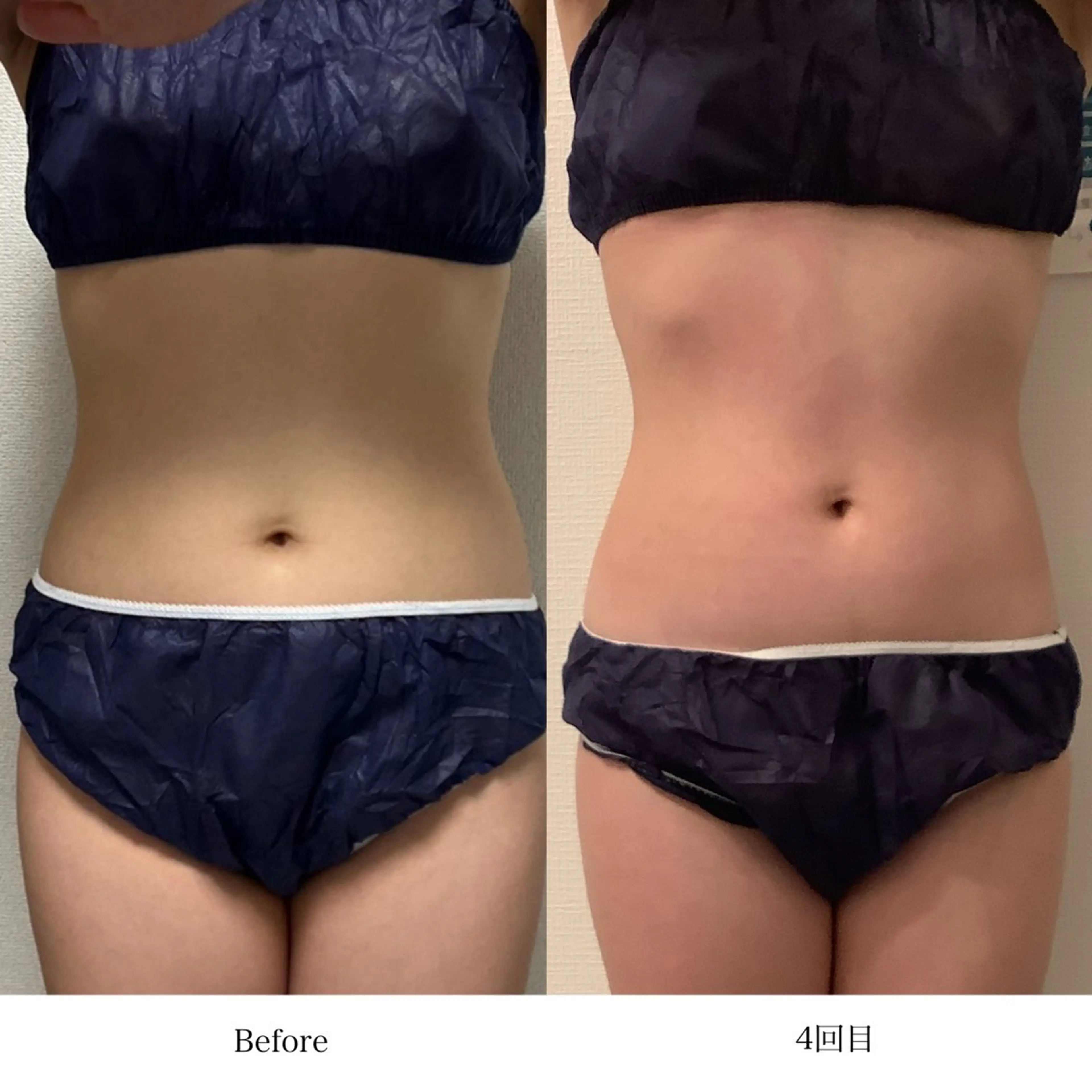 冷却専門店 SLARIのエステ・リラクイメージ