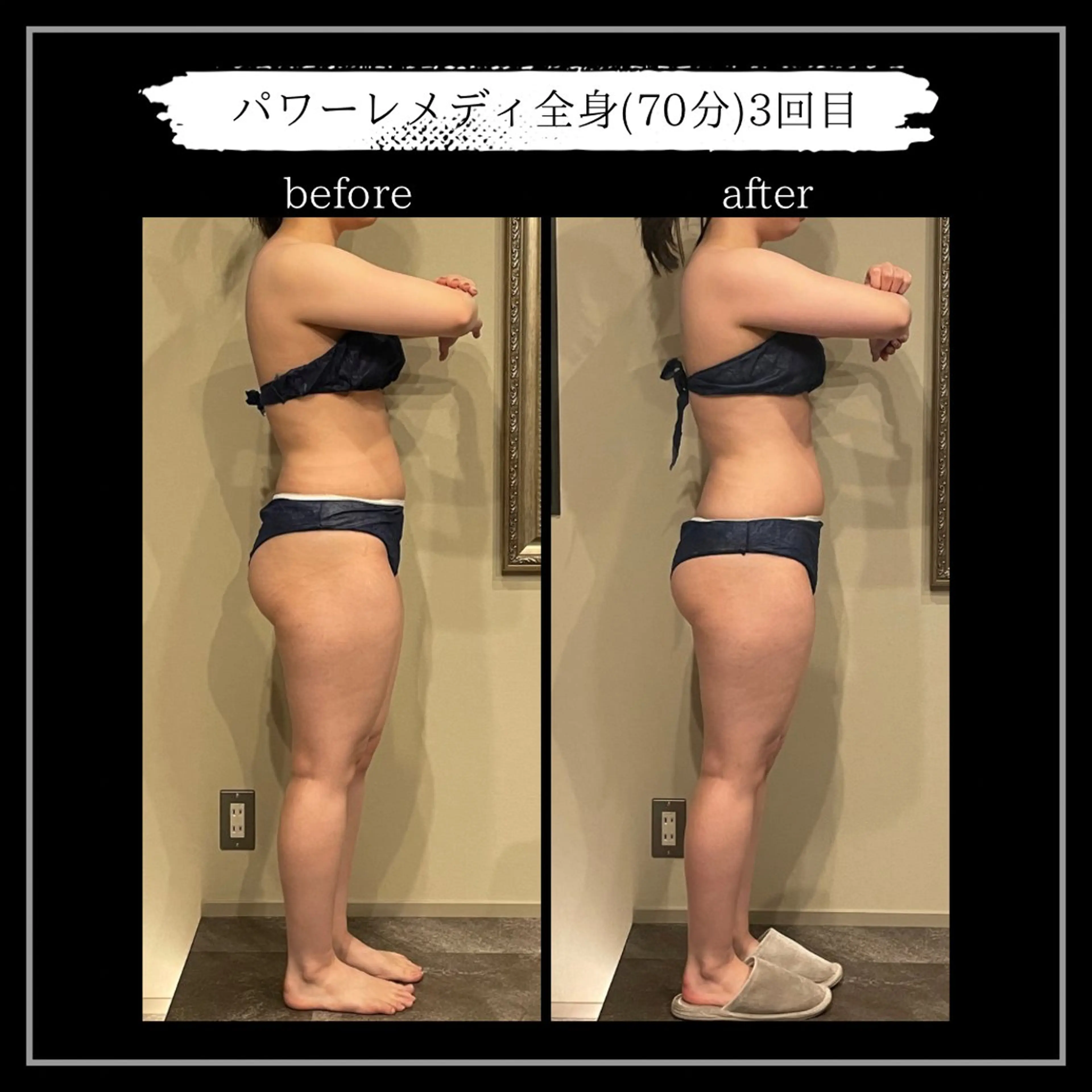 オフ:オン所属・オフ:オン 全身筋膜マッサージのエステ・リラクイメージ