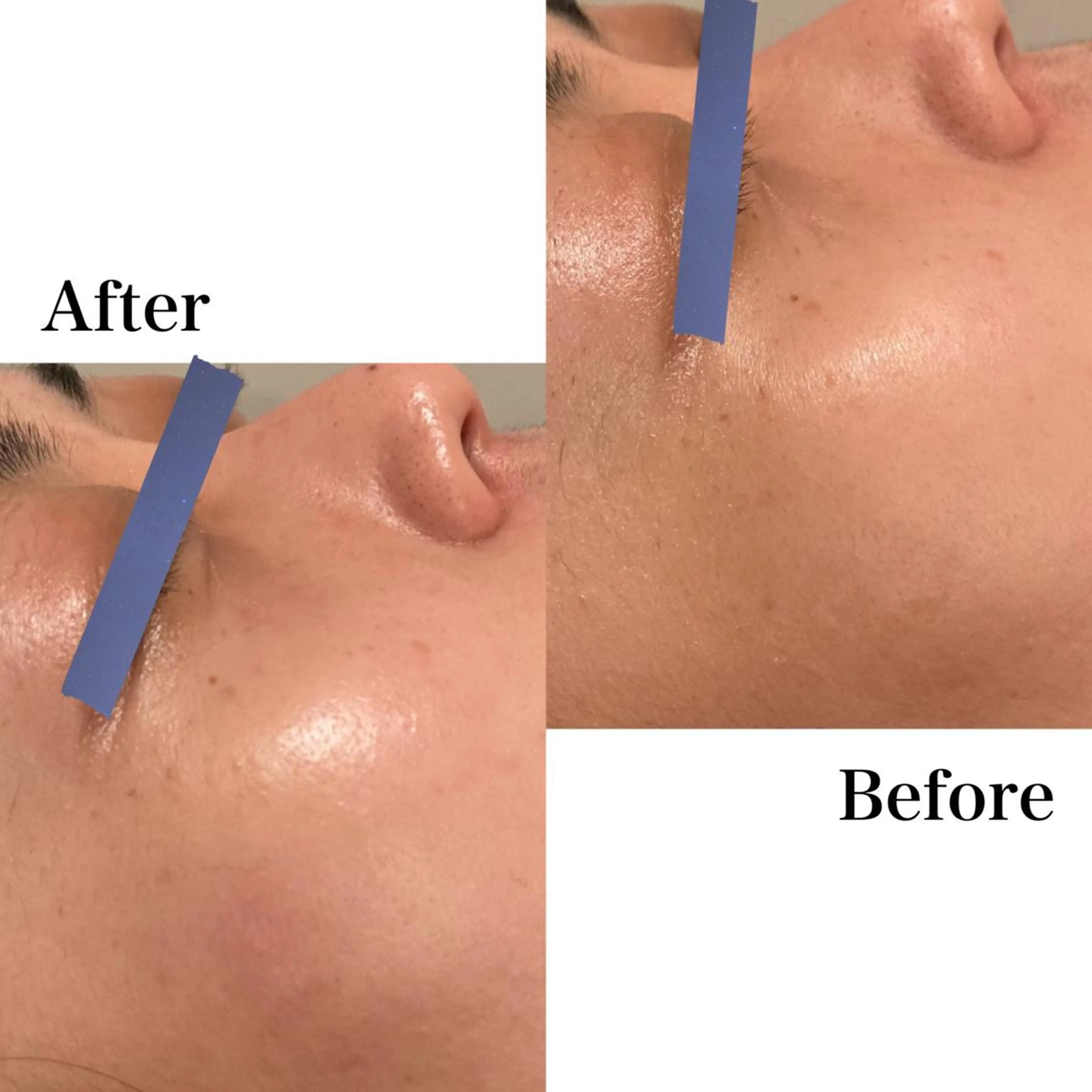 Ｂ&H所属・頭痛•肩こり専門/ 眉サロンB&H心斎橋のエステ・リラクイメージ