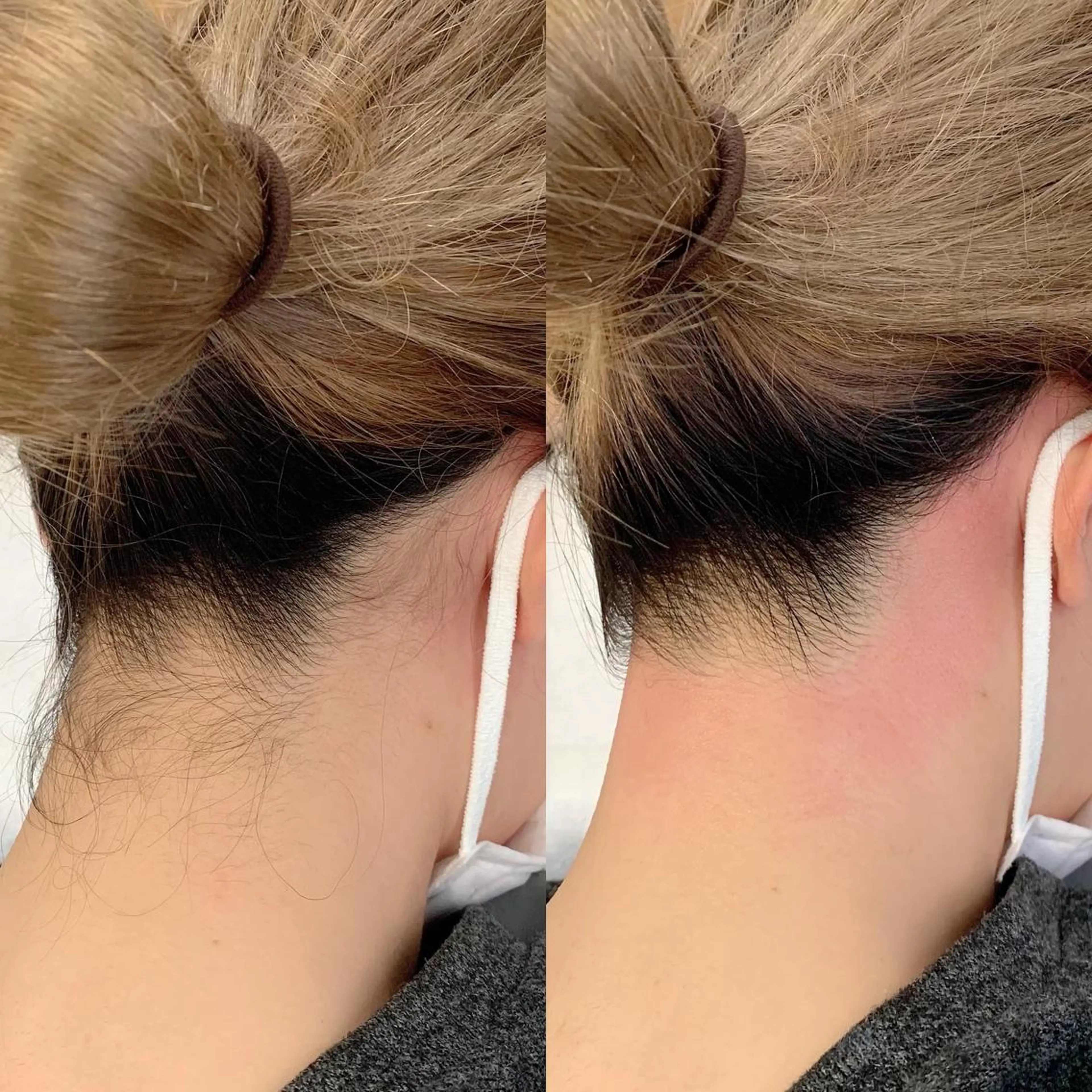 脱毛 salonLADYSTYLE所属・稲嶺 美華のエステ・リラクイメージ