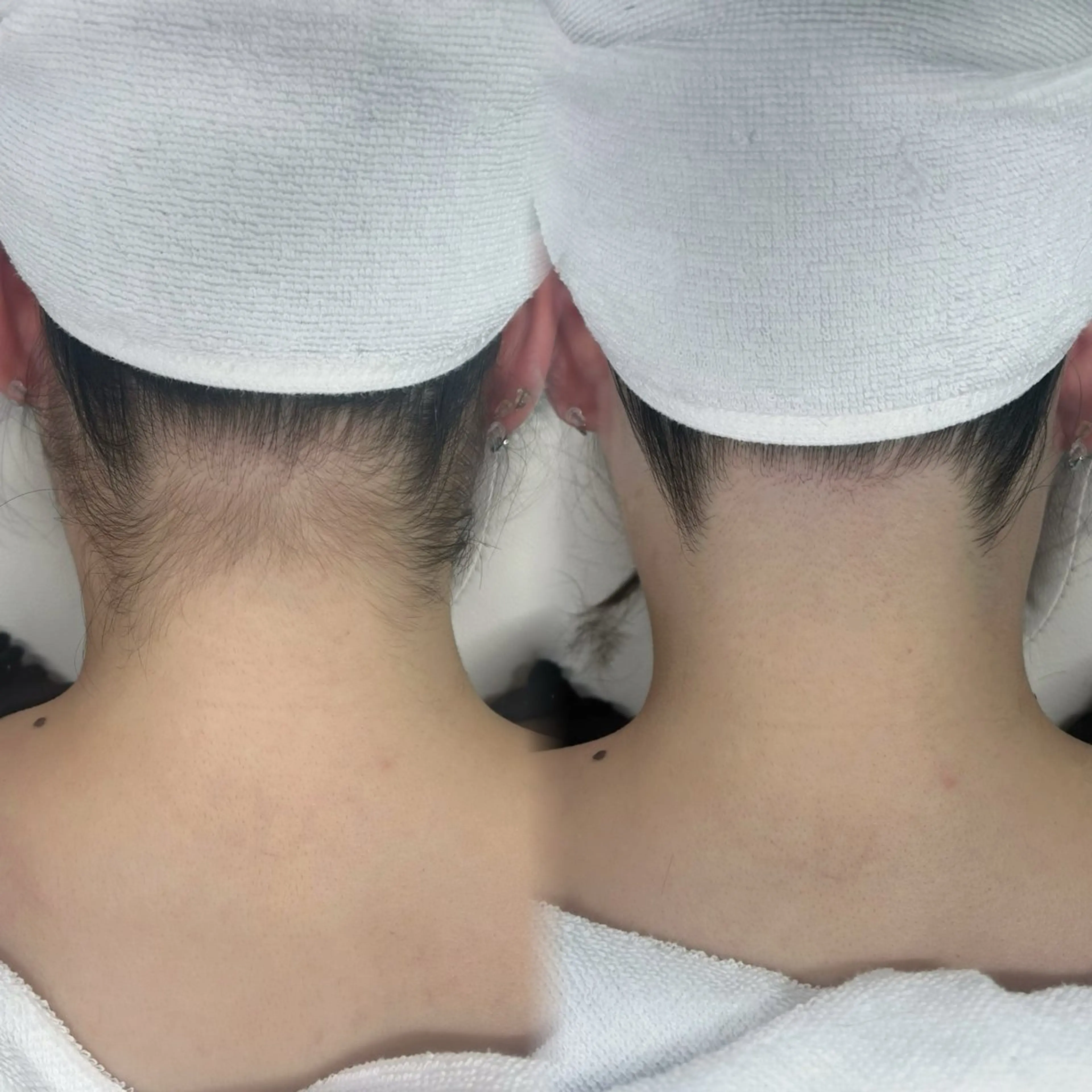 脱毛 かんな🤍 眉毛/脱毛の眉毛・アイブロウイメージ