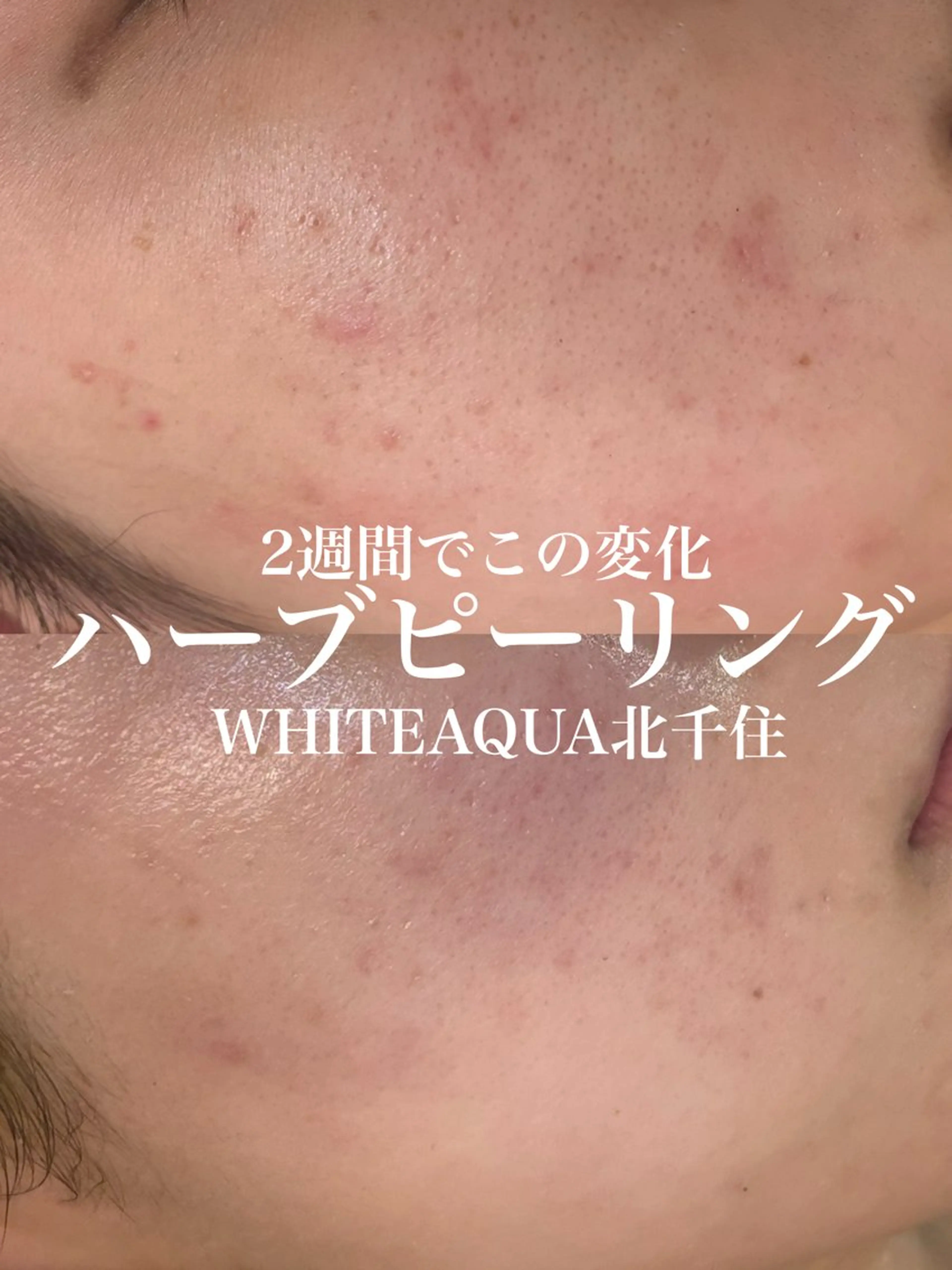 エステ WHITE AQUA 北千住店のエステ・リラクイメージ
