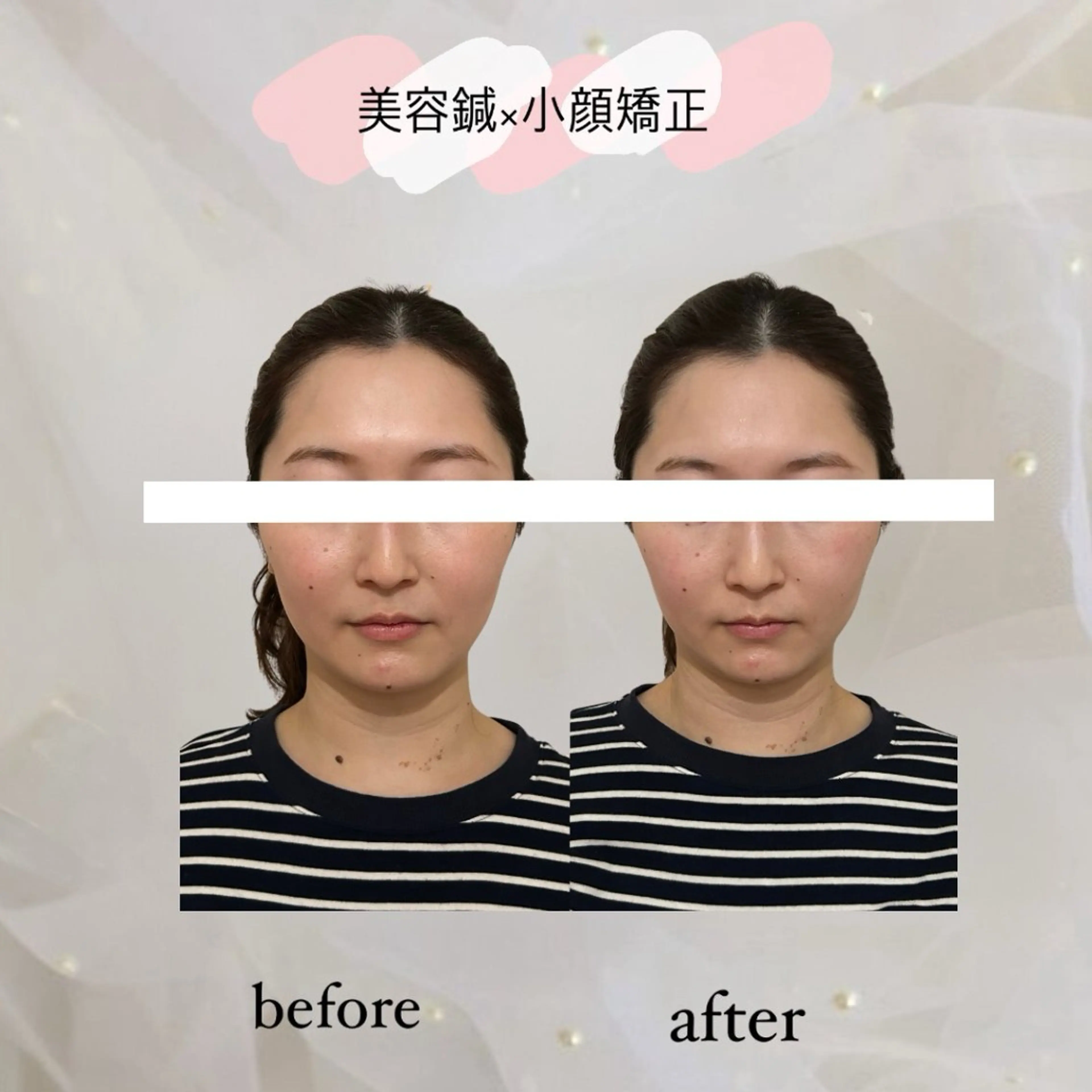 エステ リラク harisalon aleumのエステ・リラクイメージ