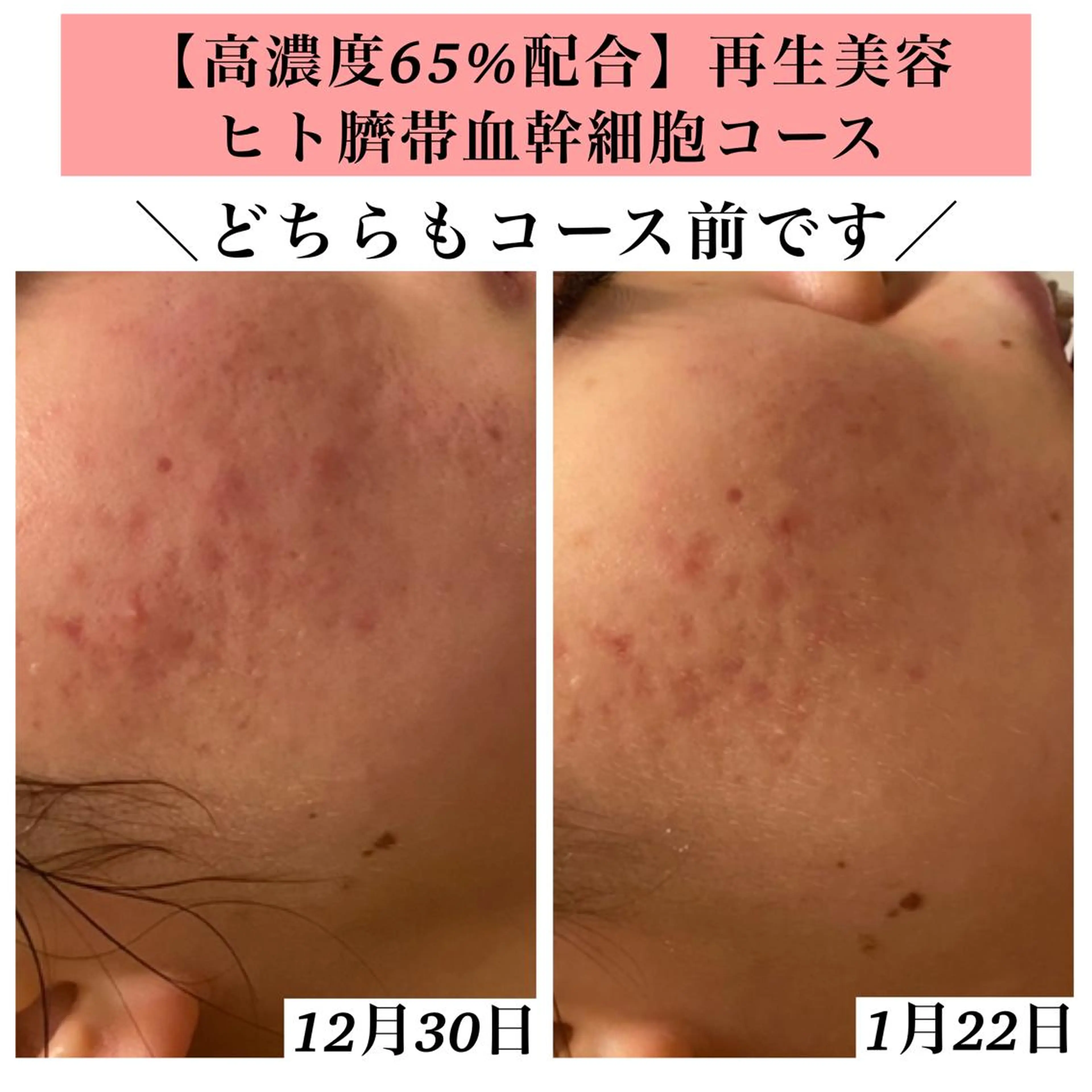 エステ リラク Bellesthe (ベルエステ)のエステ・リラクイメージ