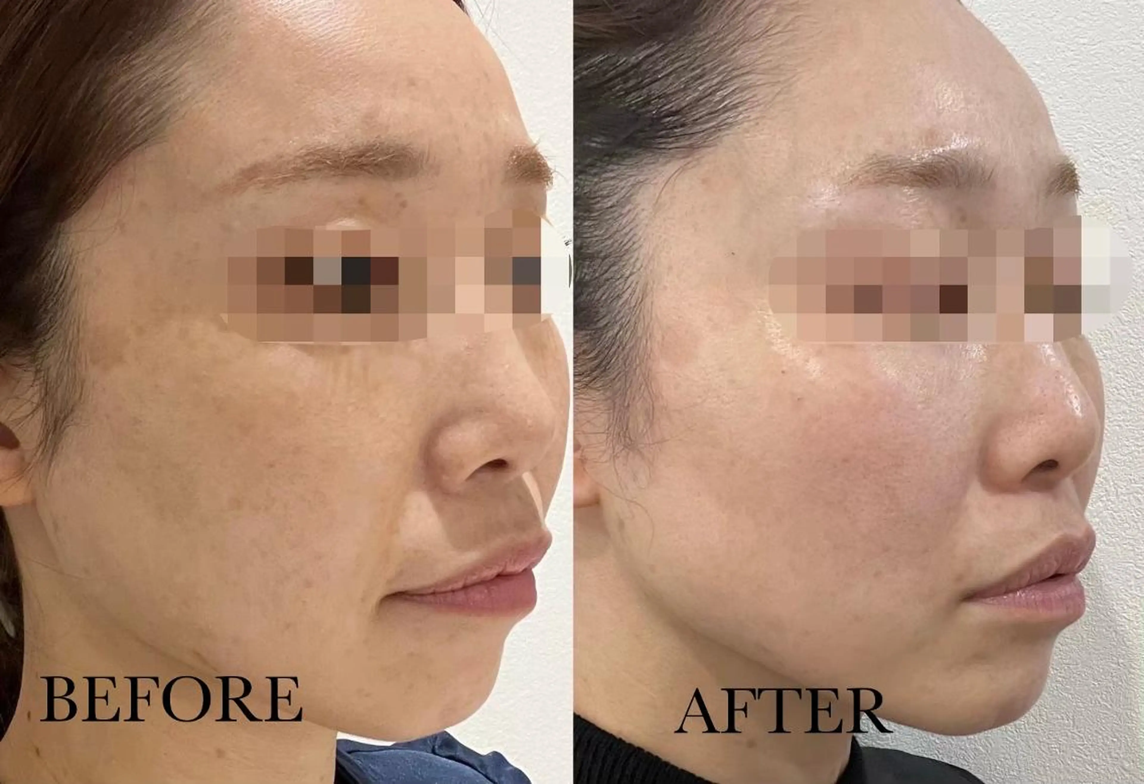 sii センター北 AIのエステ・リラクイメージ