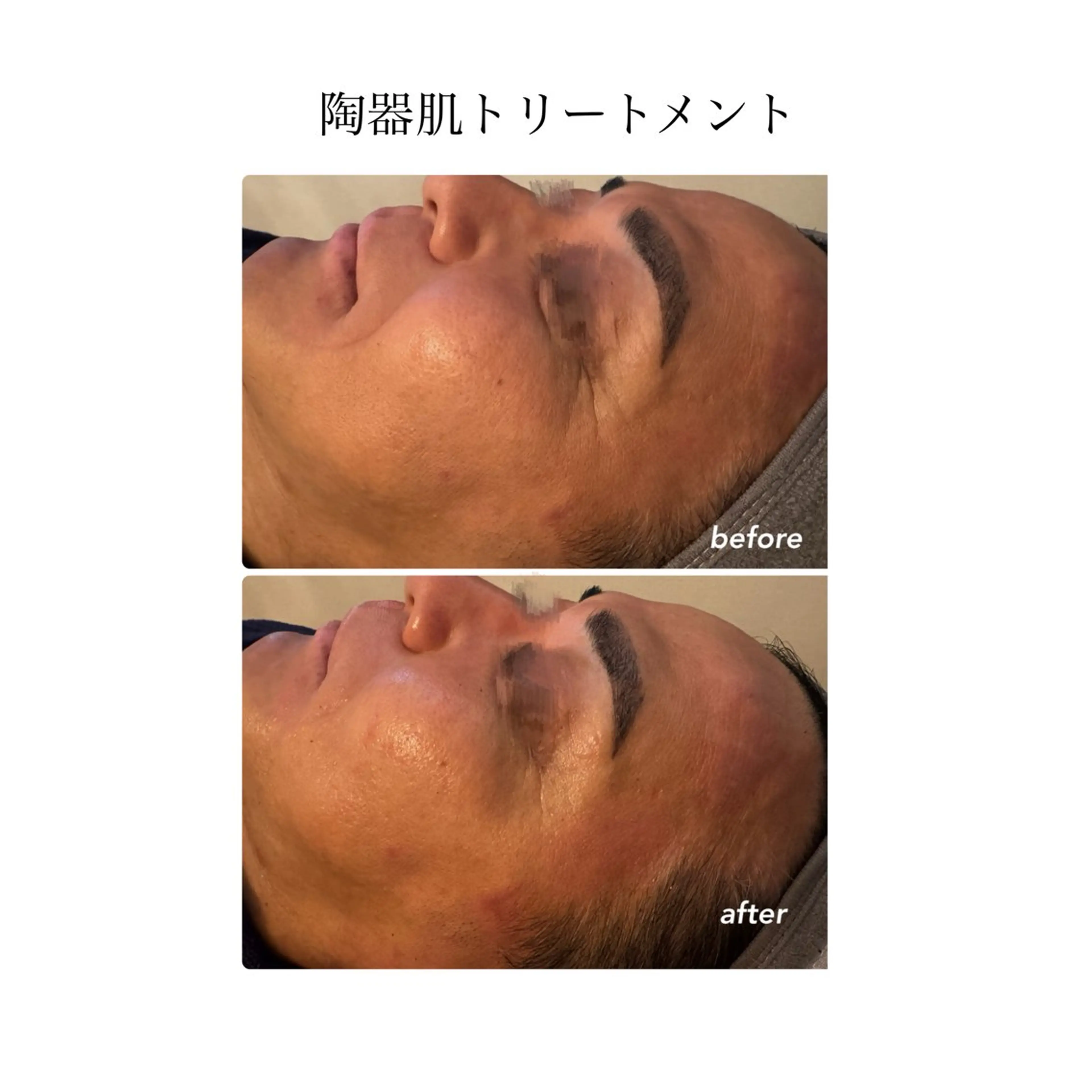 Esthesalon MOONのエステ・リラクイメージ